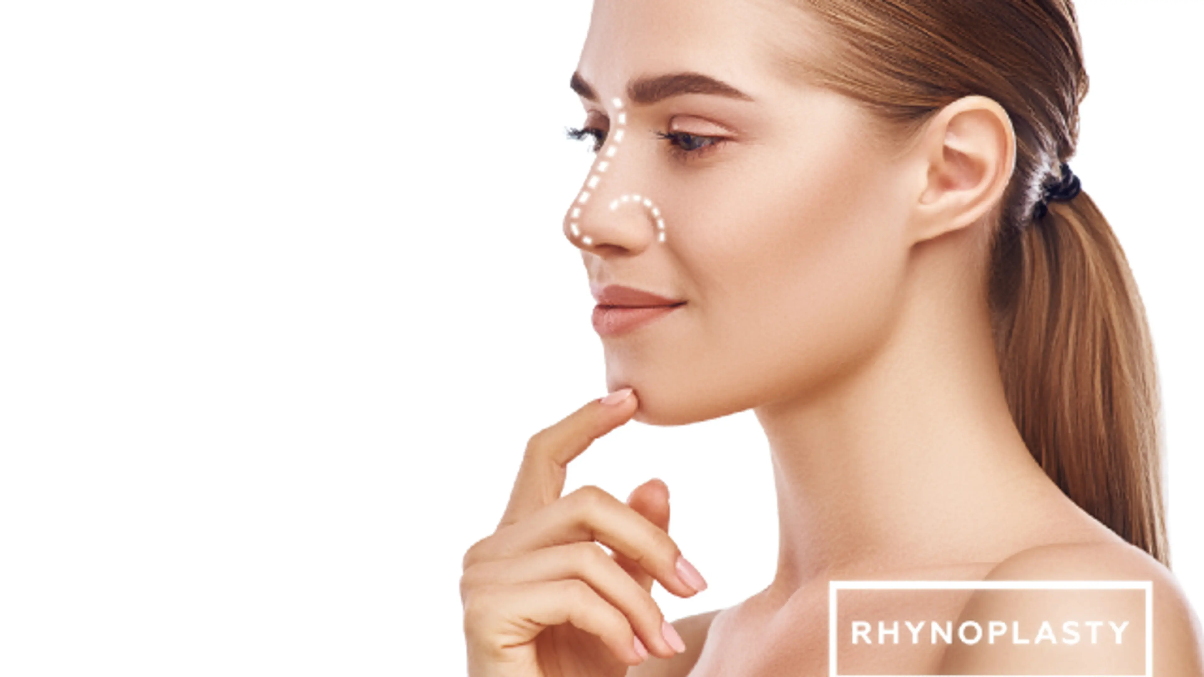 Rhinoplasty