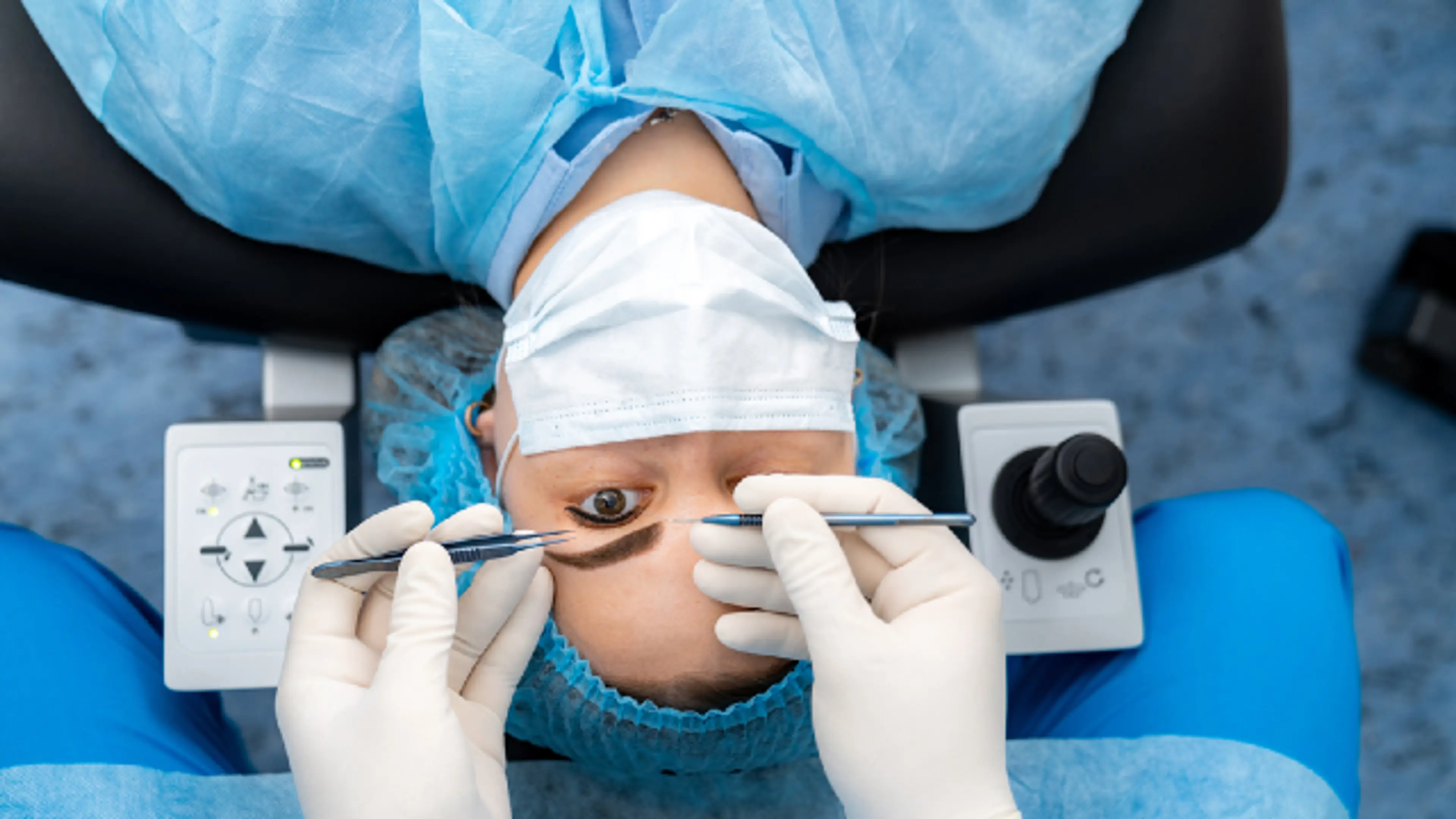 SMILE LASIK eye surgery procedure for vision correction treatment