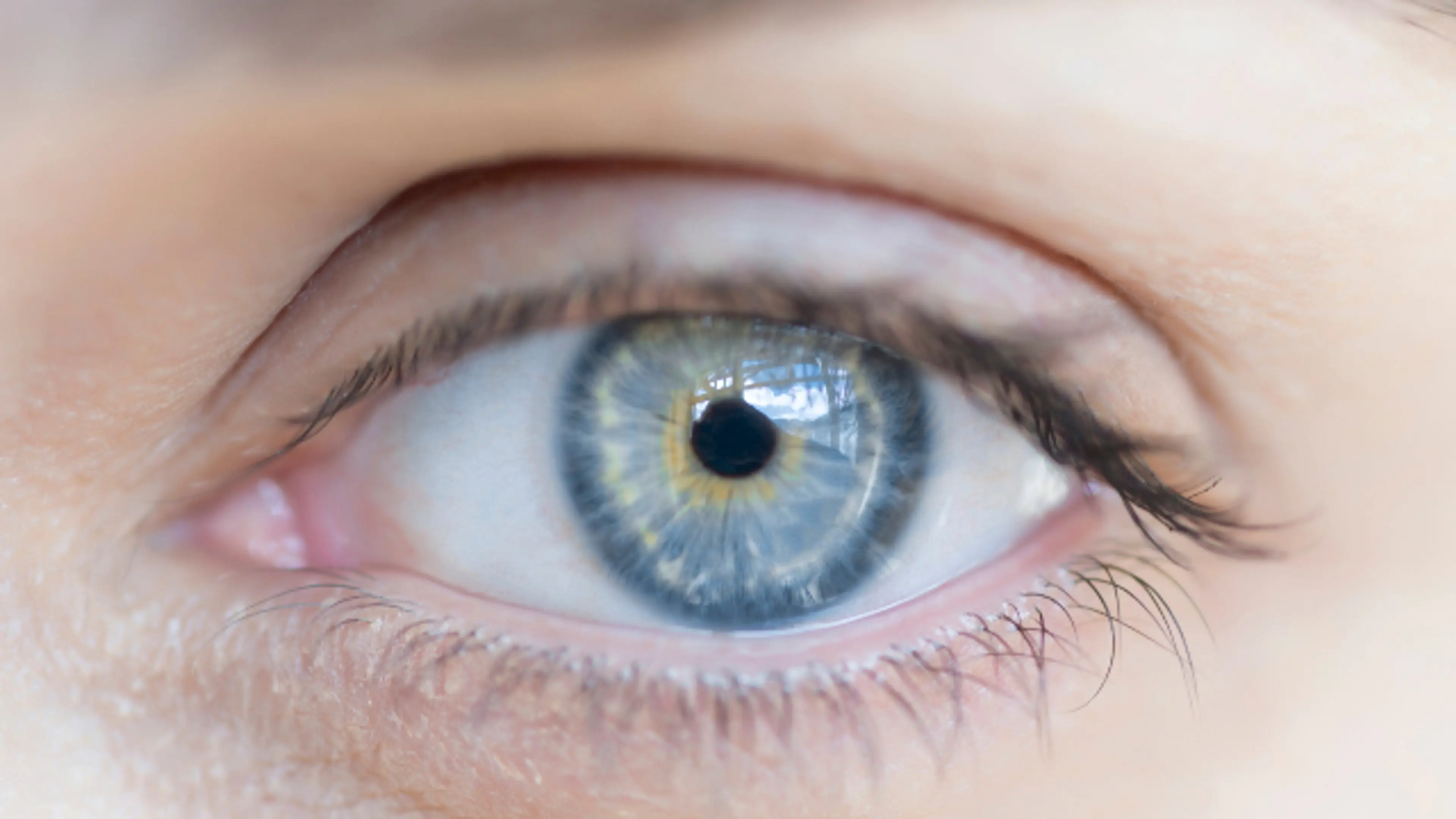 LASIK