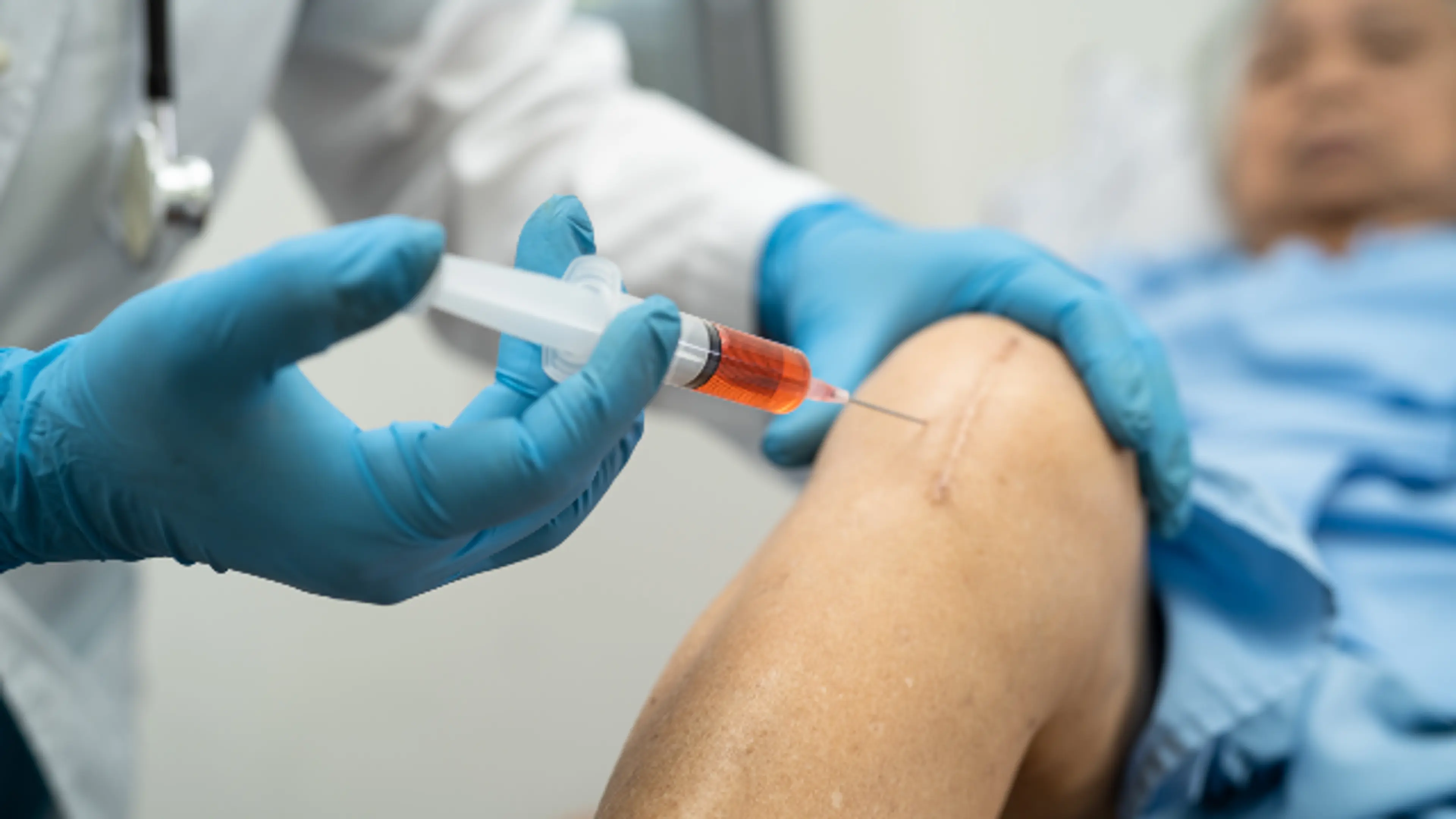 干细胞治疗 (Stem Cell Therapy)