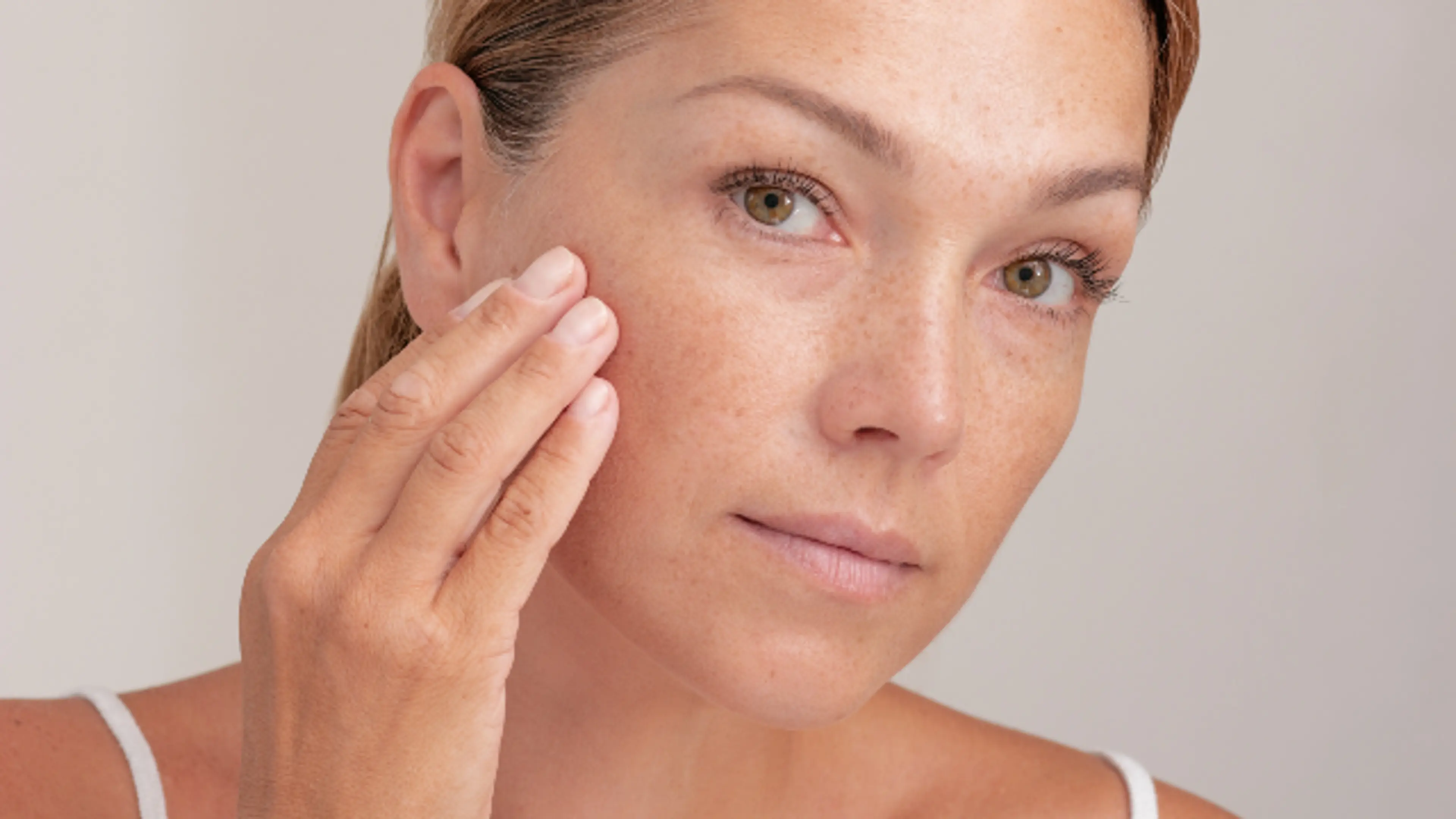 Pigmentation