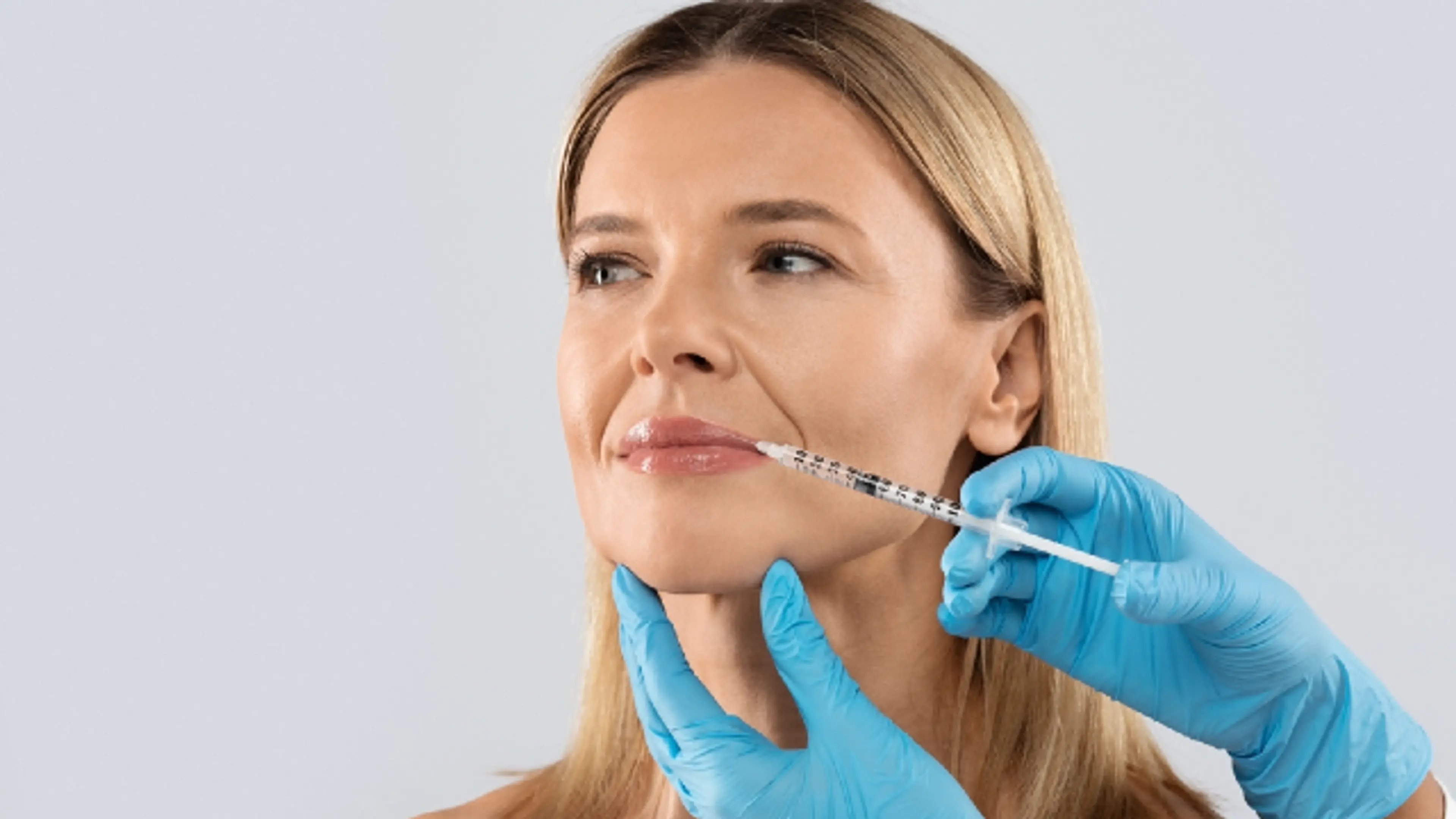 Collagen Fillers.