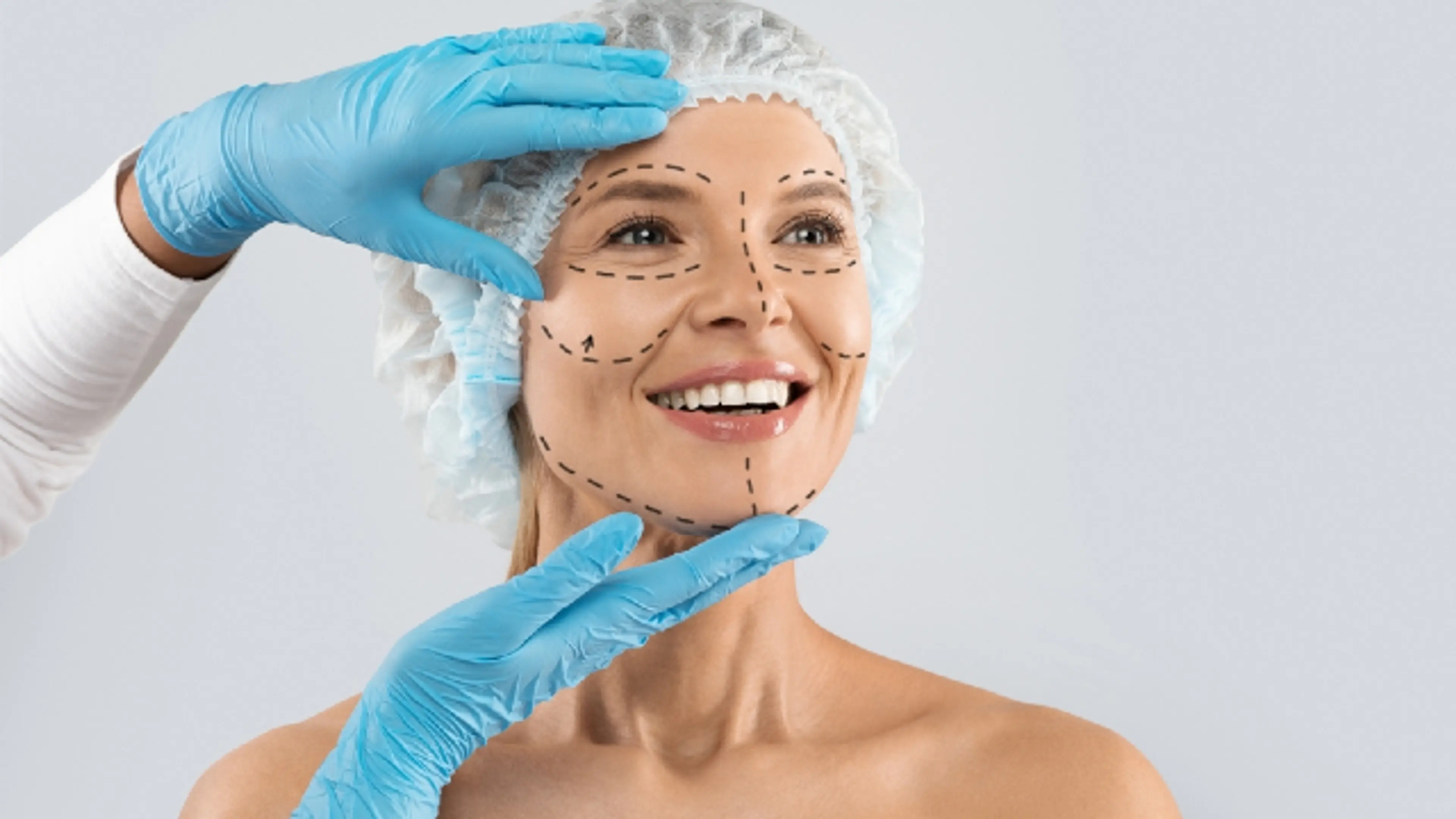 Facelift