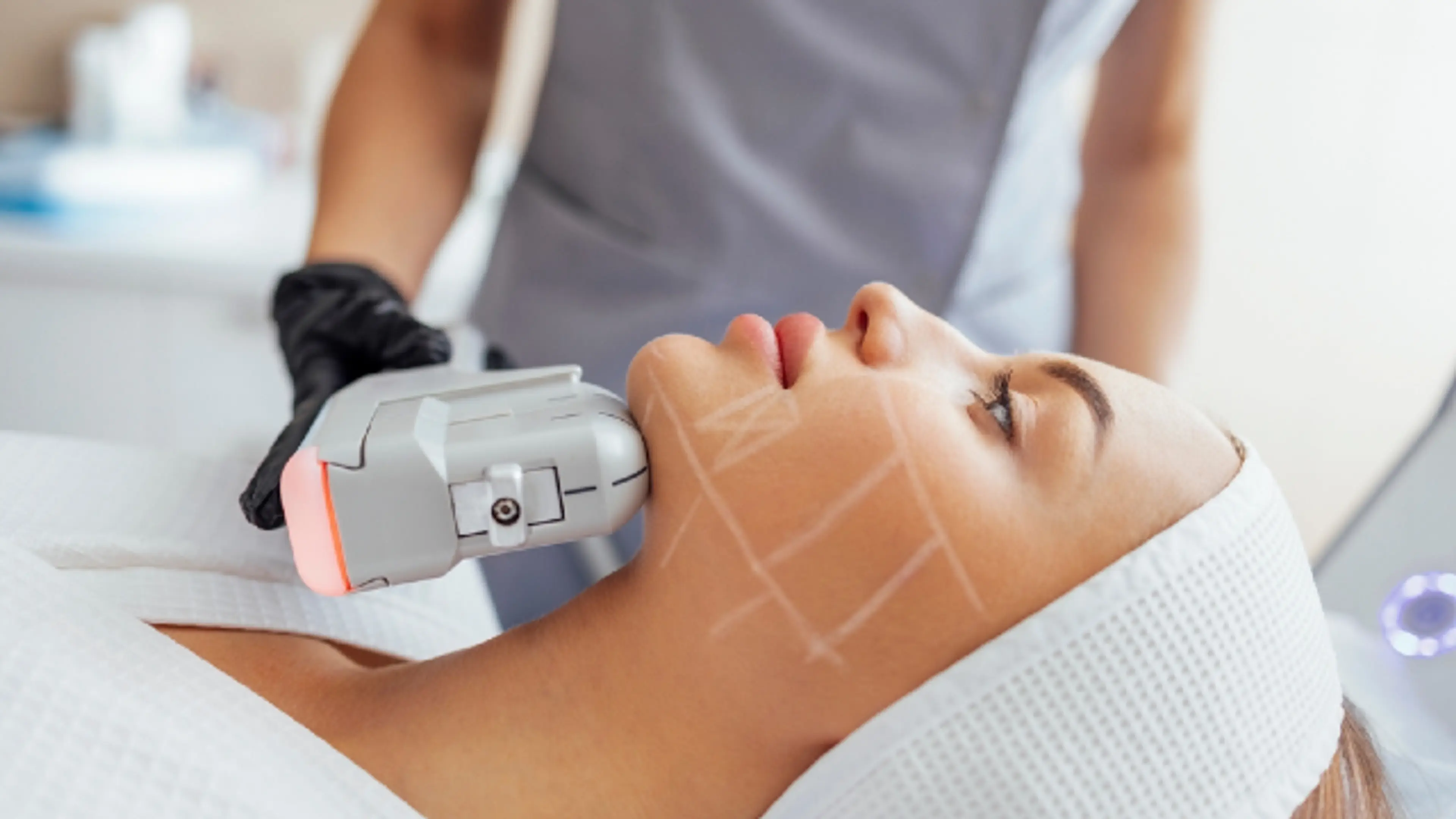 A patient receiving a professional HIFU or non-surgical face lift treatment on the jawline and neck area at a cosmetic clinic