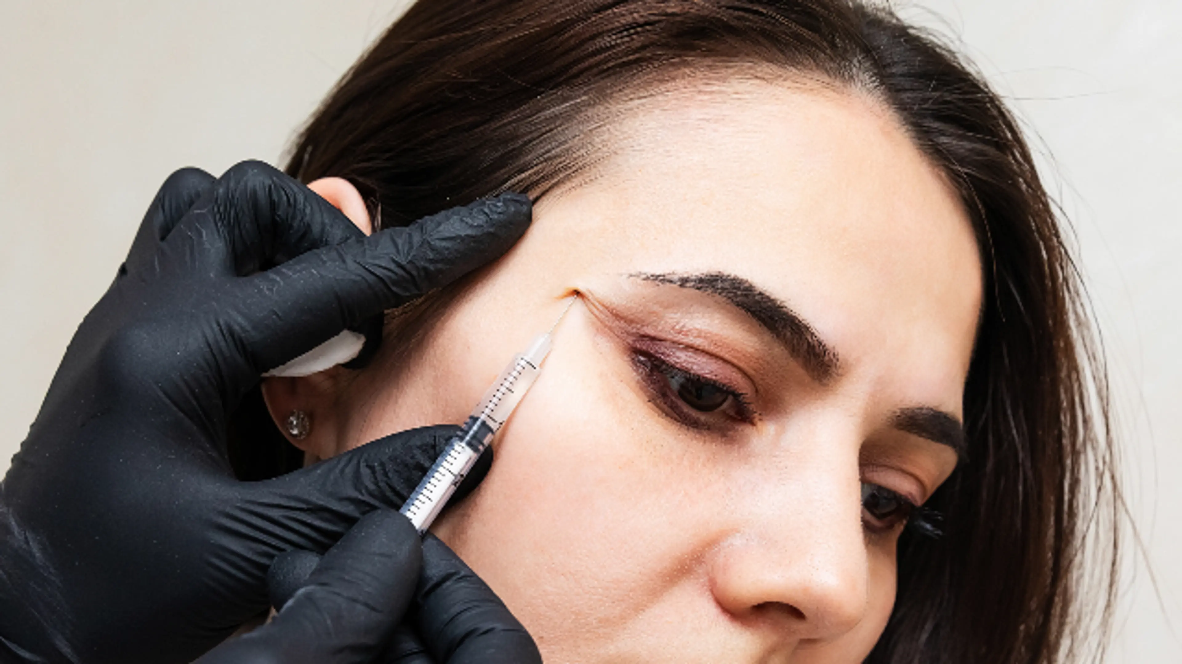 A practitioner wearing black medical gloves administers an injection near the outer corner of a woman's eye using a syringe.