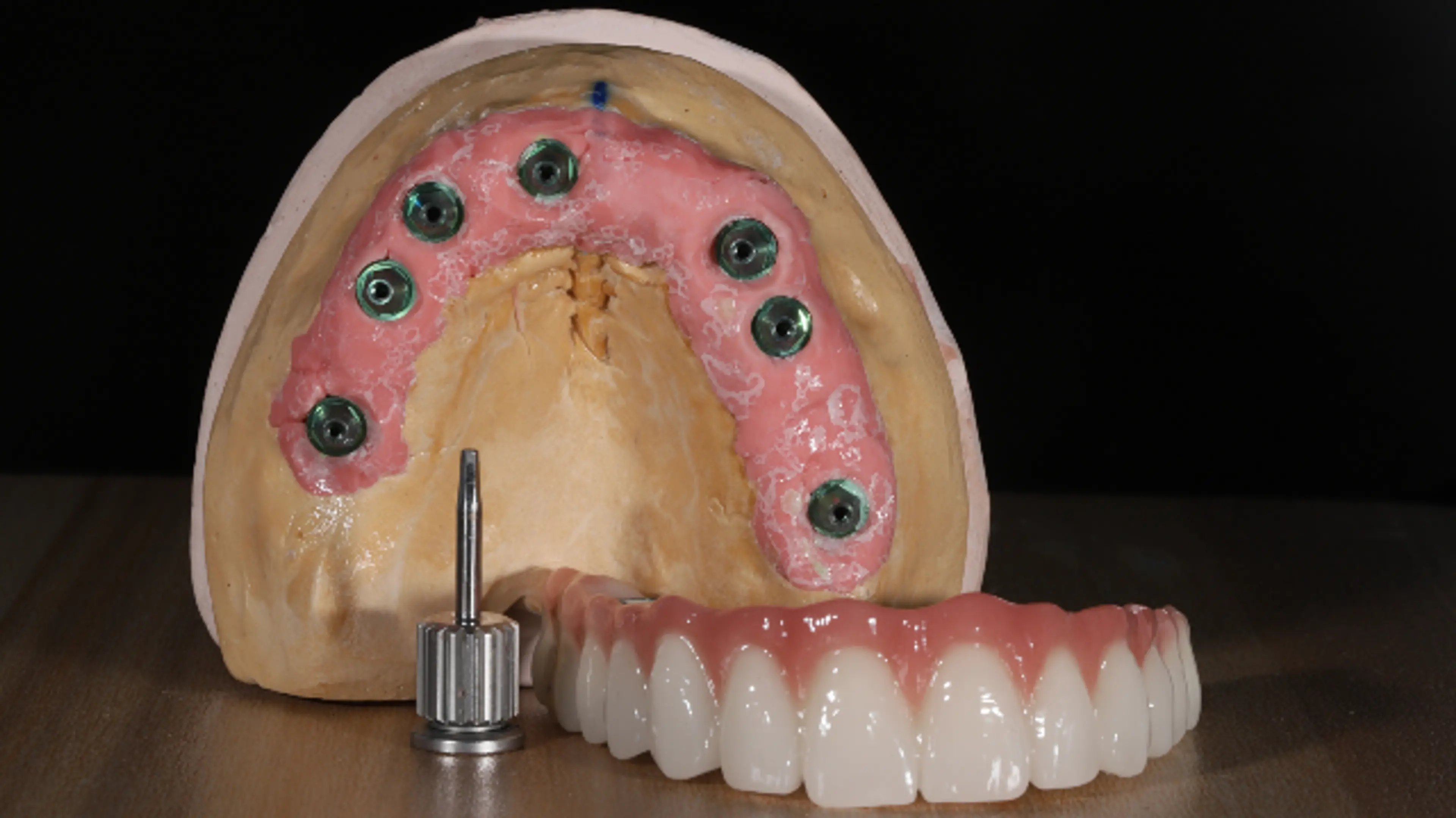 TMJ treatment At OnO Dental Clinic