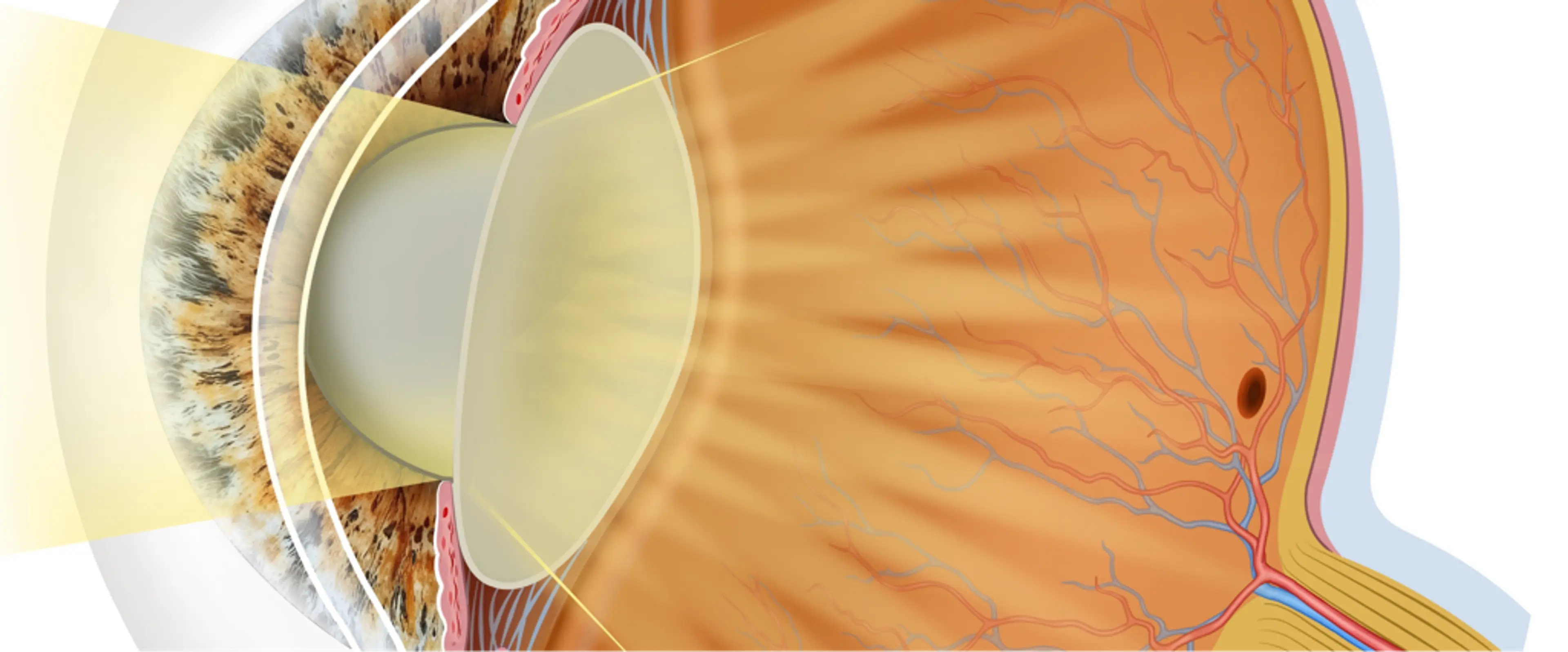 GS Eye Center