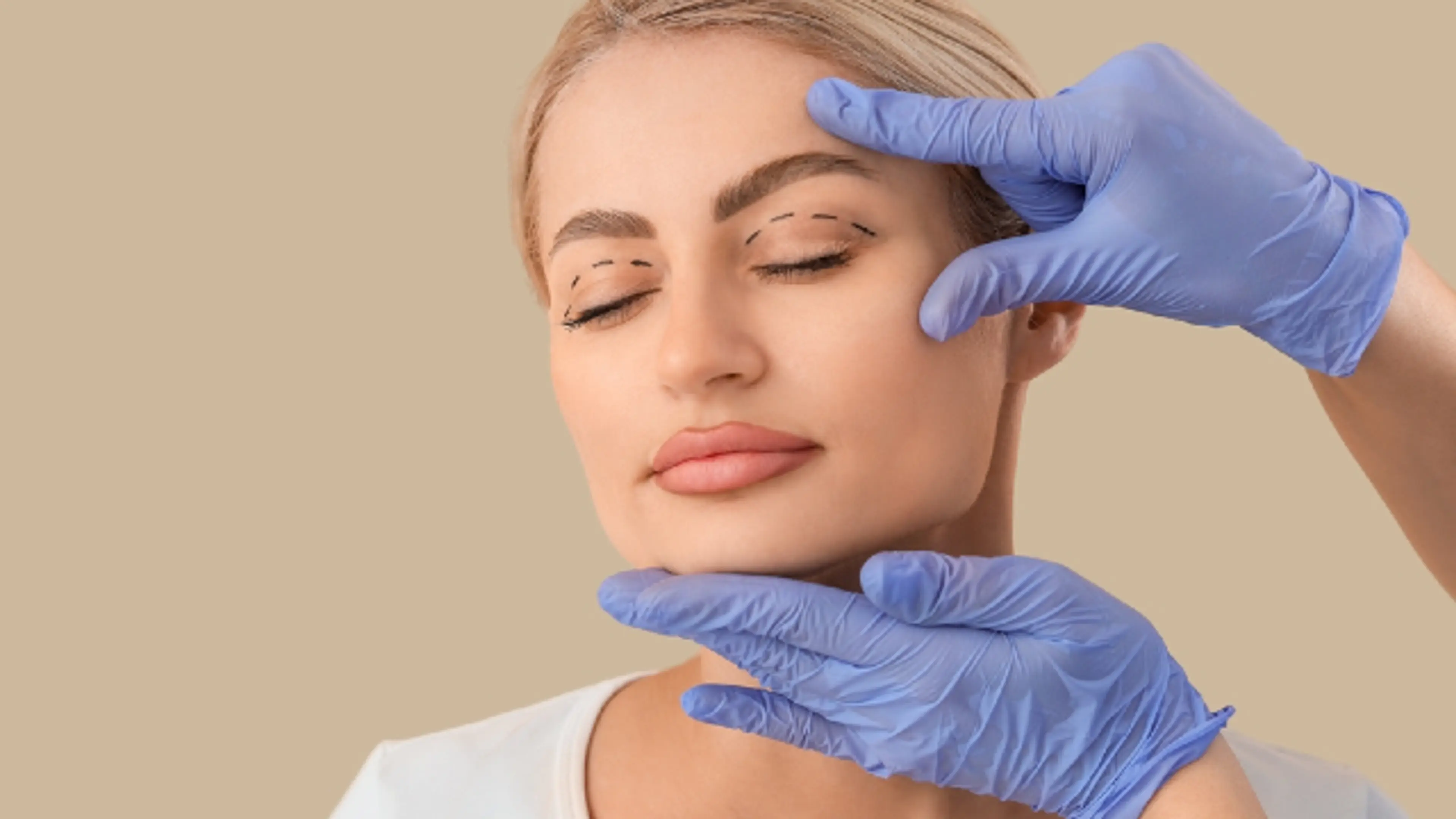 Double eyelid surgery planning with eyelid crease.