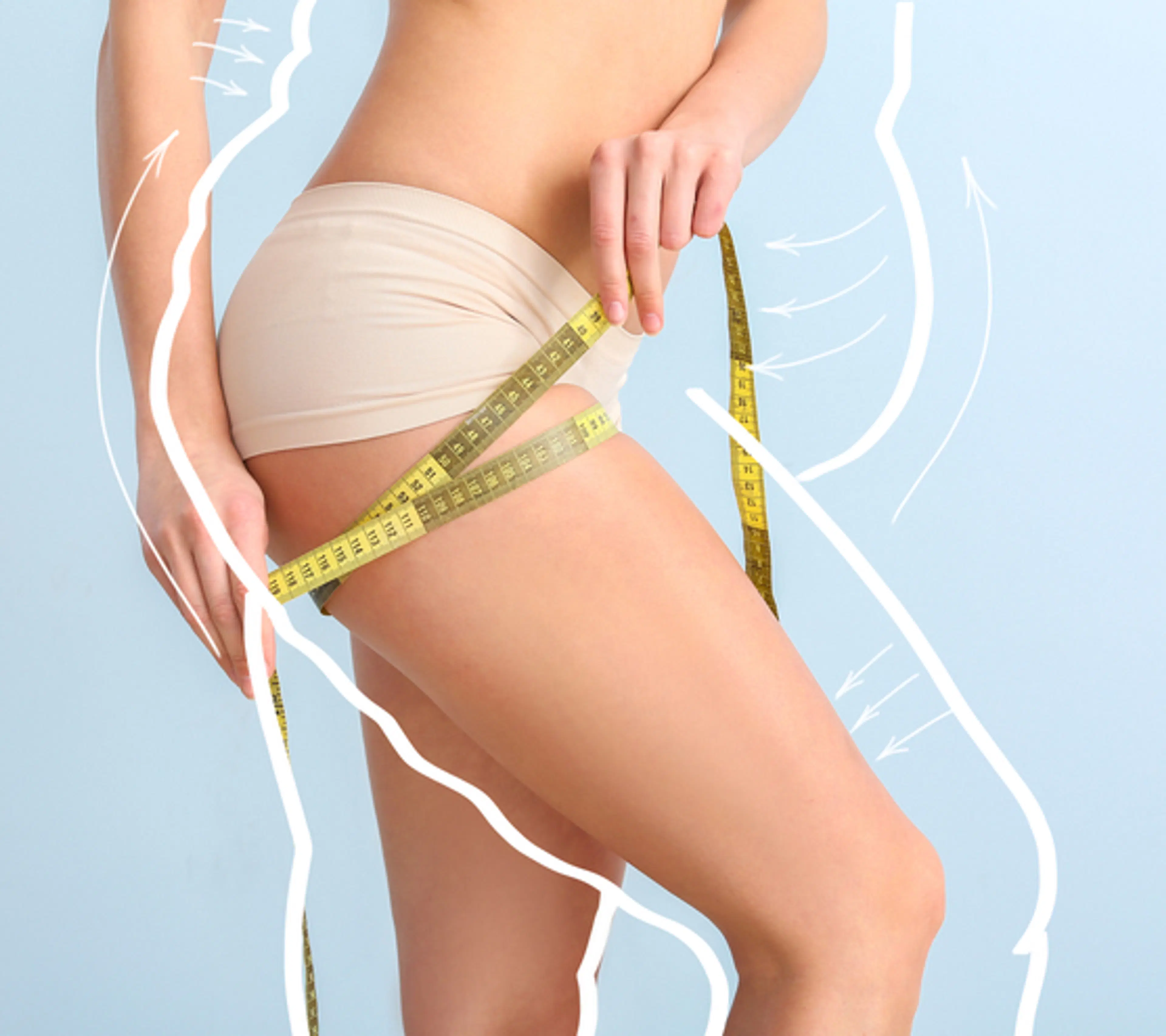 Liposuction
