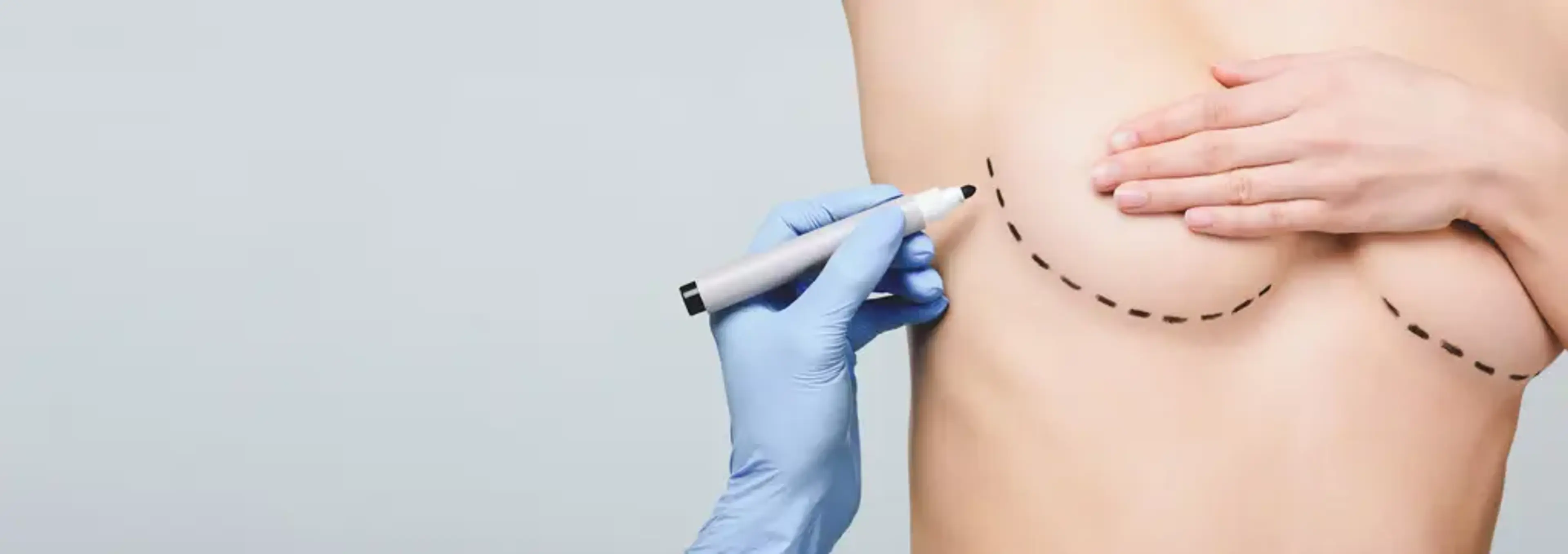 Human Plastic Surgery