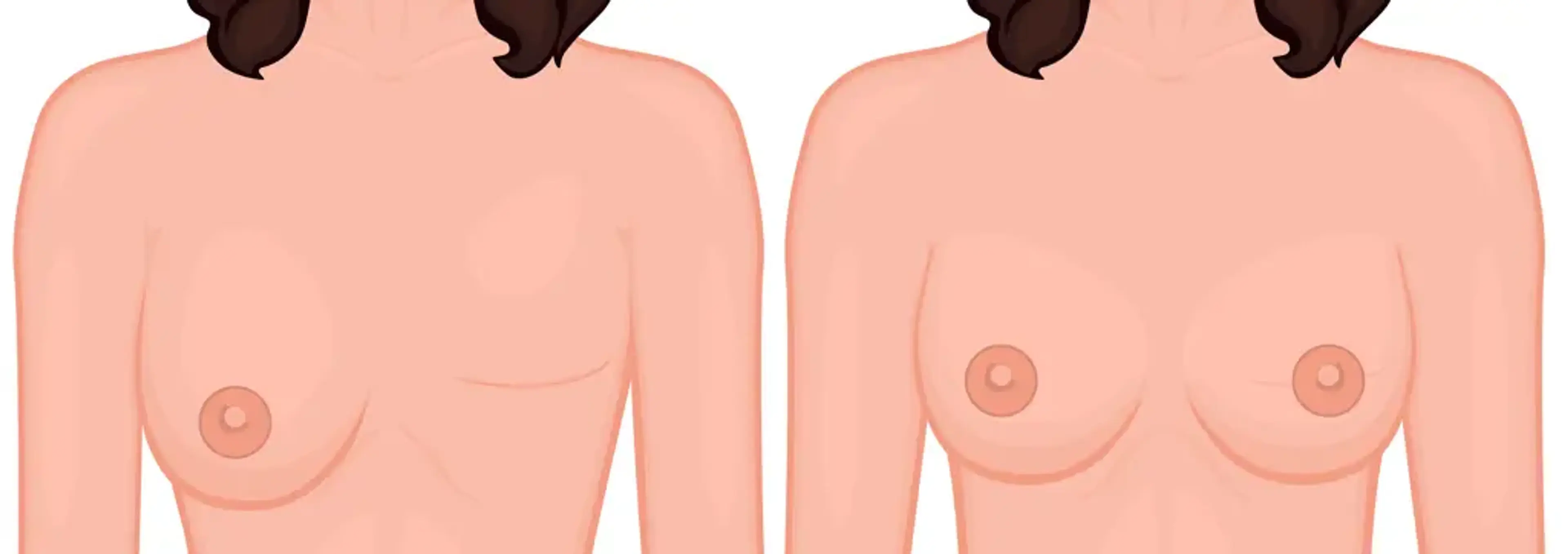 Human Plastic Surgery
