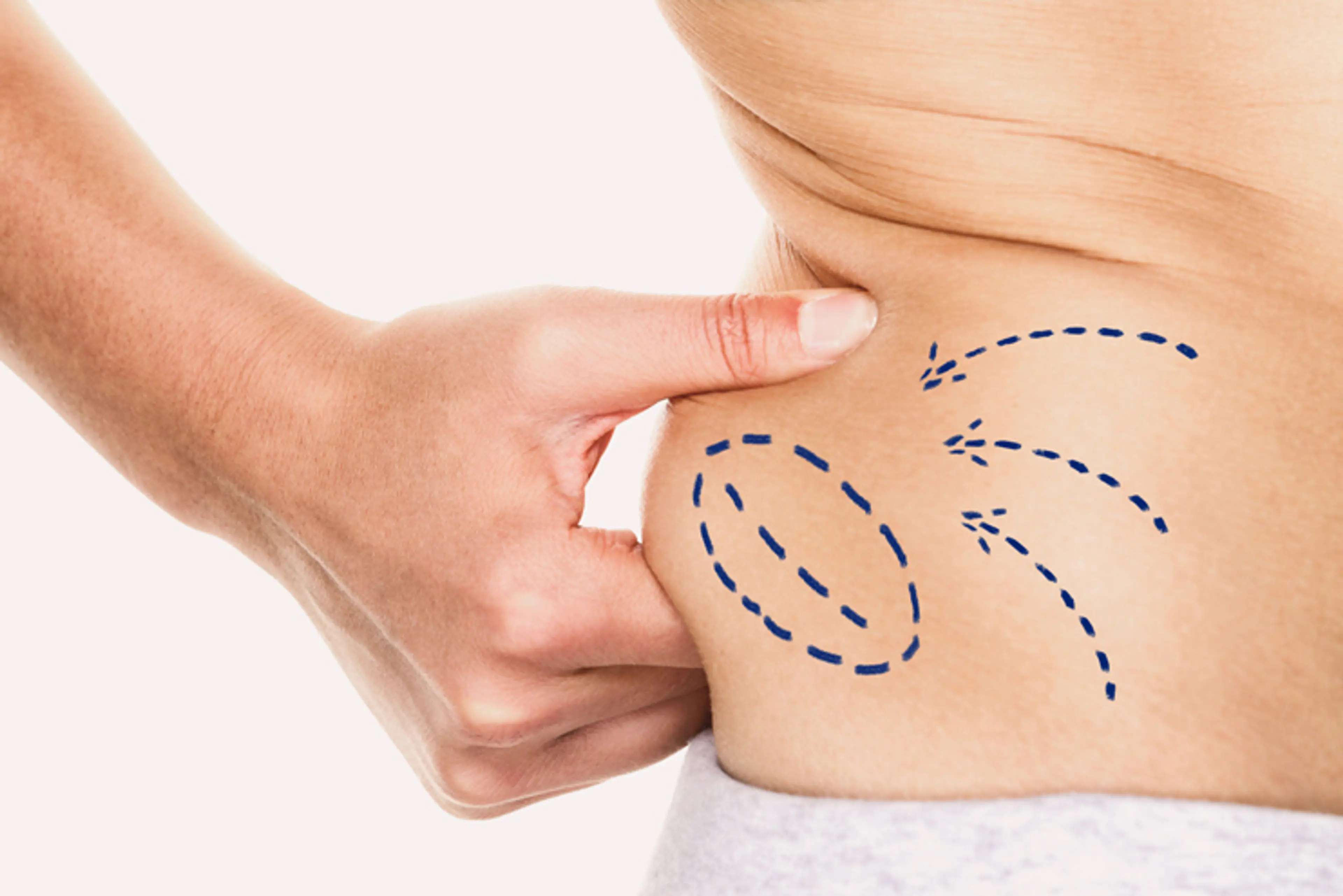 fat reduction