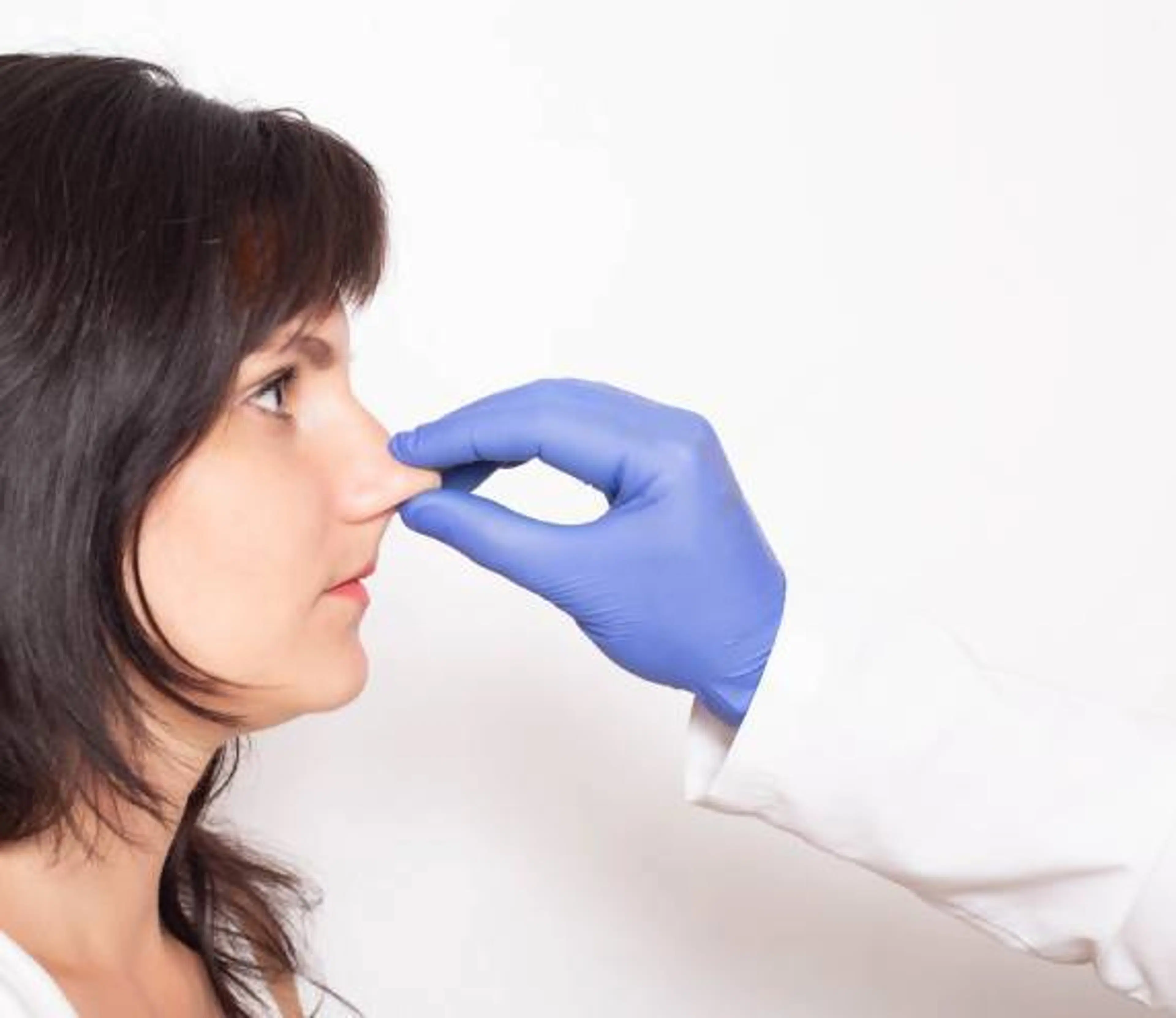 Non-Implant Rhinoplasty