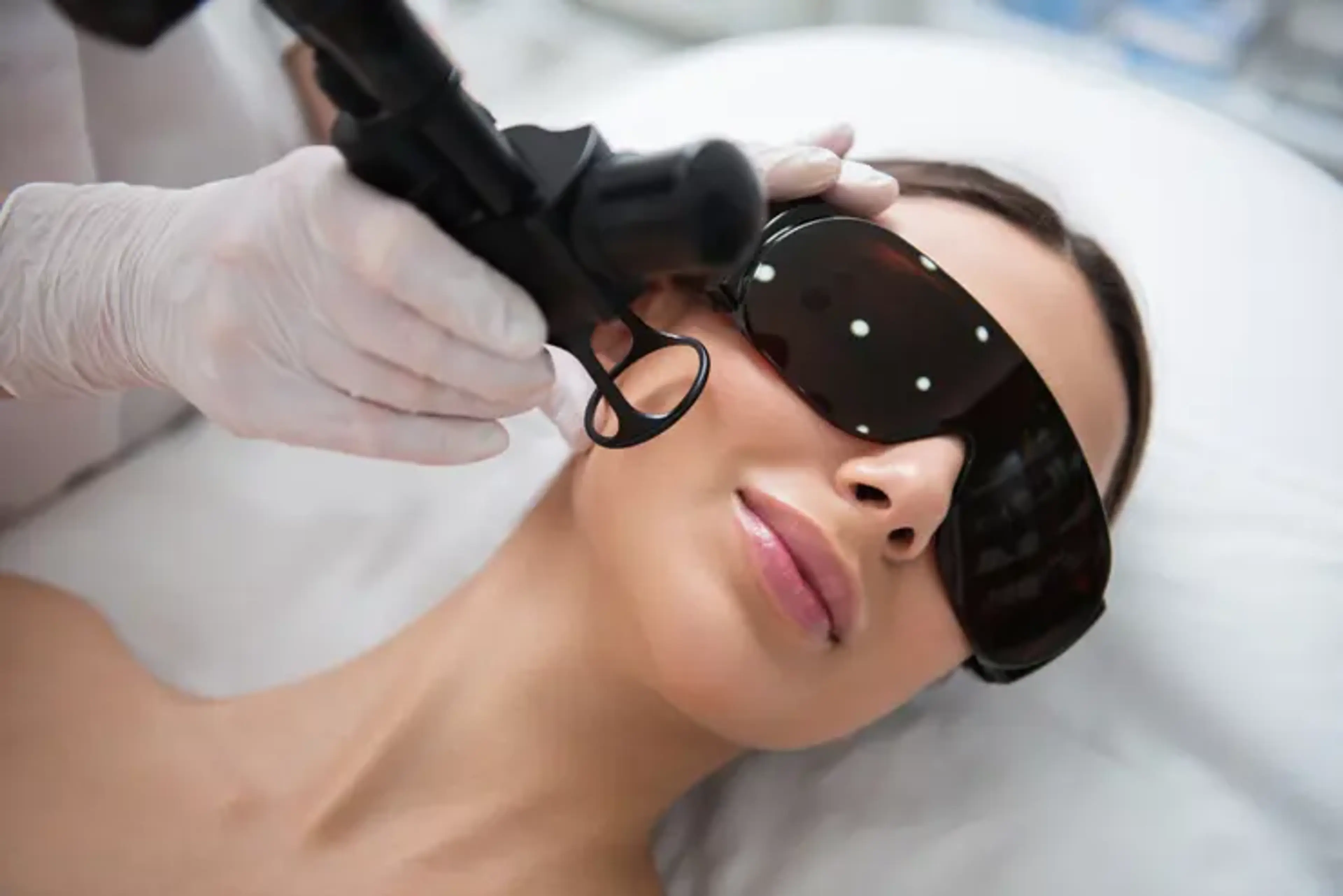 Fractional CO2 Laser Treatment?