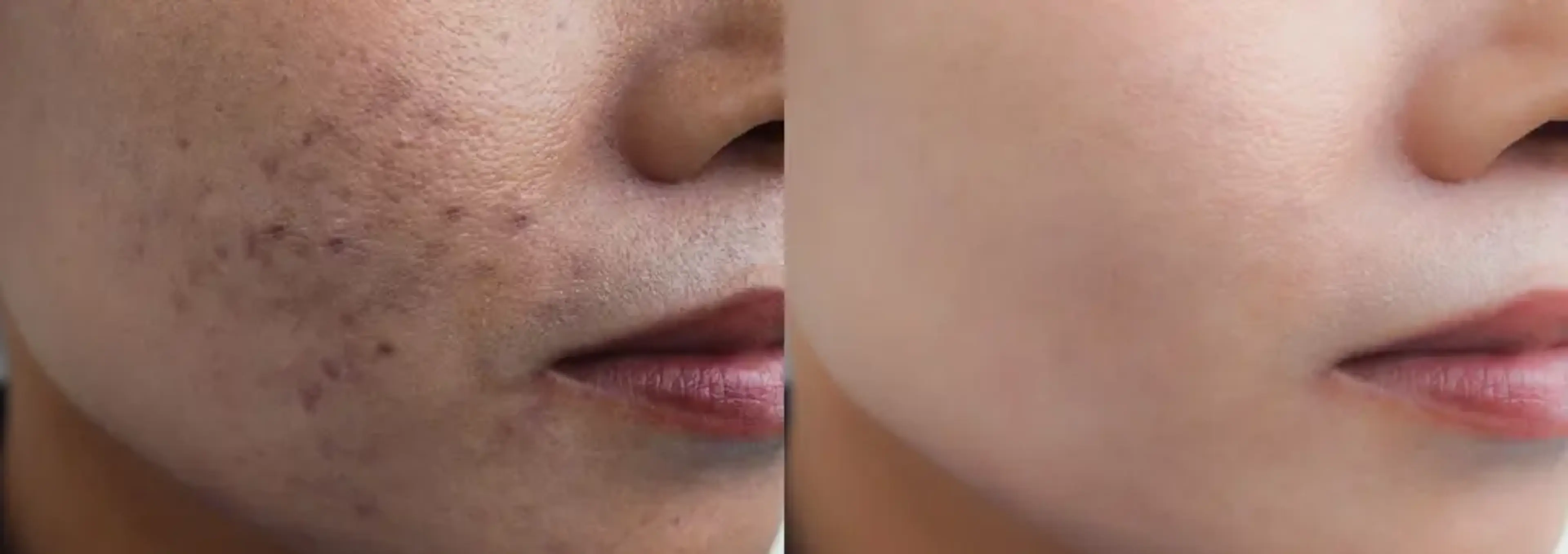 Arke Clinic Plastic Surgery and Aesthetic
