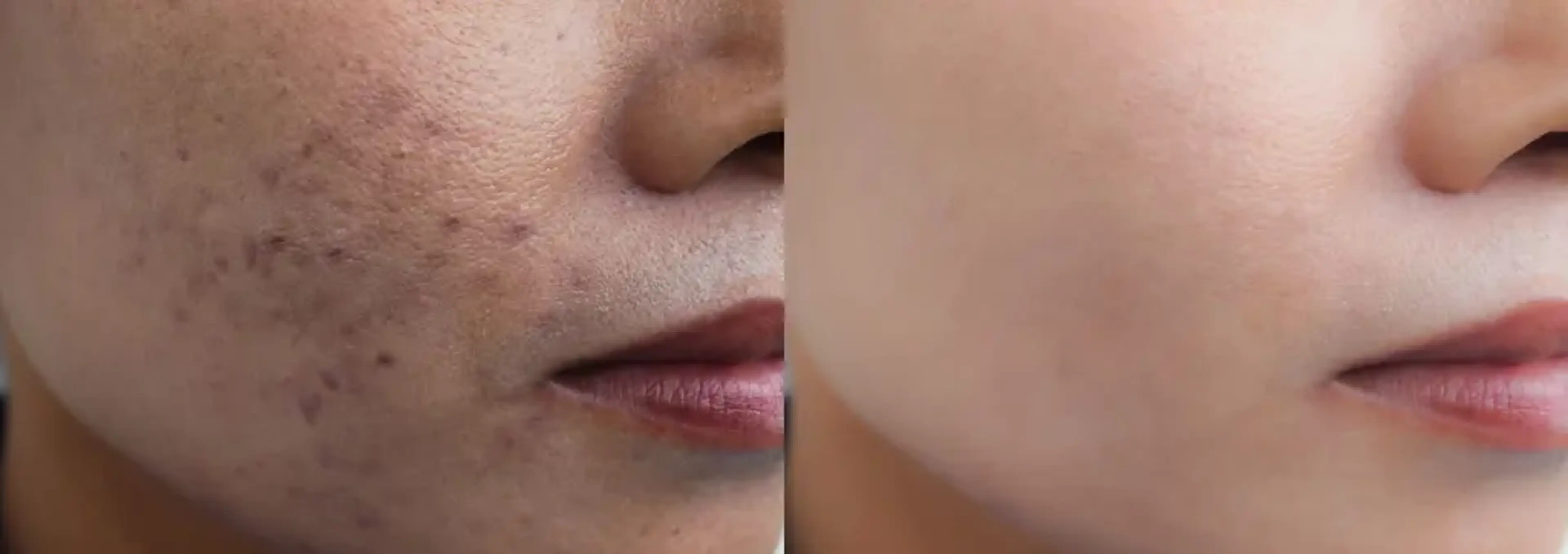 Arke Clinic Plastic Surgery and Aesthetic
