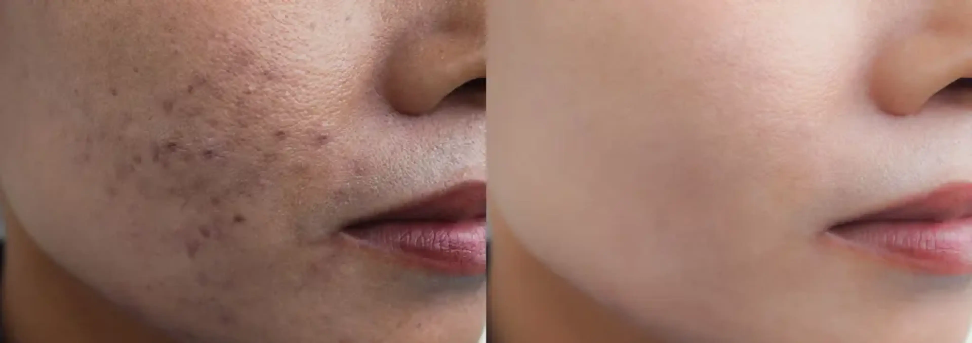 Yujin Plastic Surgery & Dermatology & Stem Cell Research Center