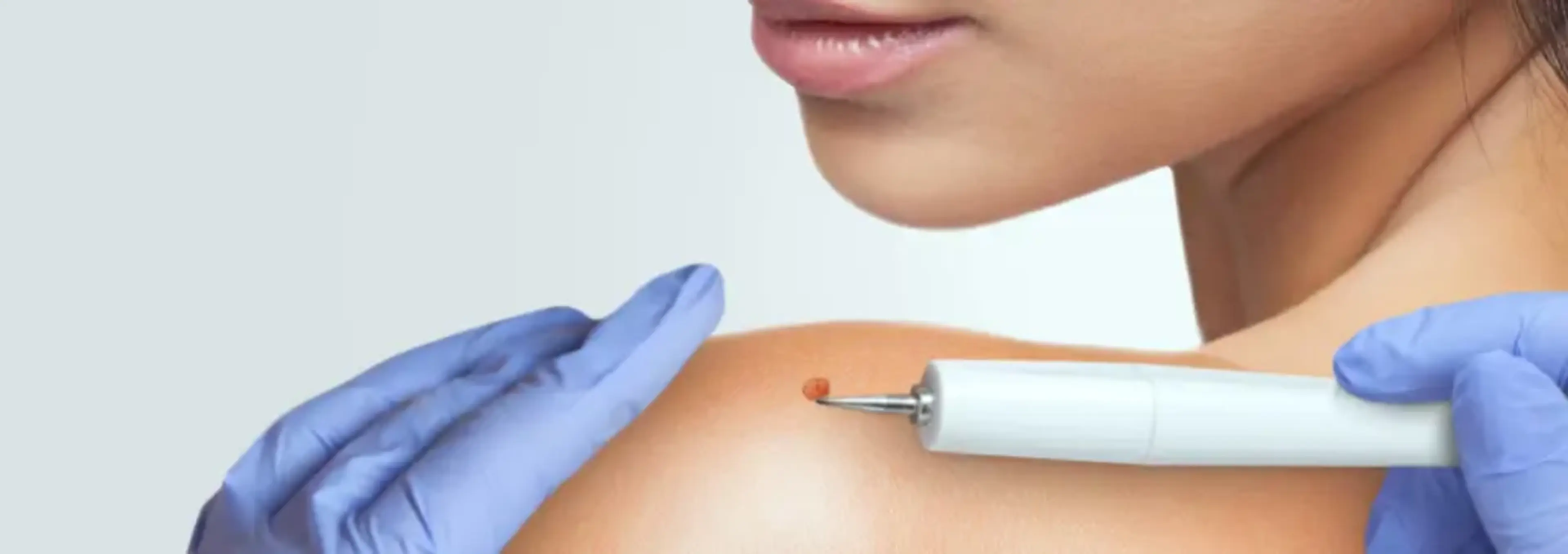 Arke Clinic Plastic Surgery and Aesthetic