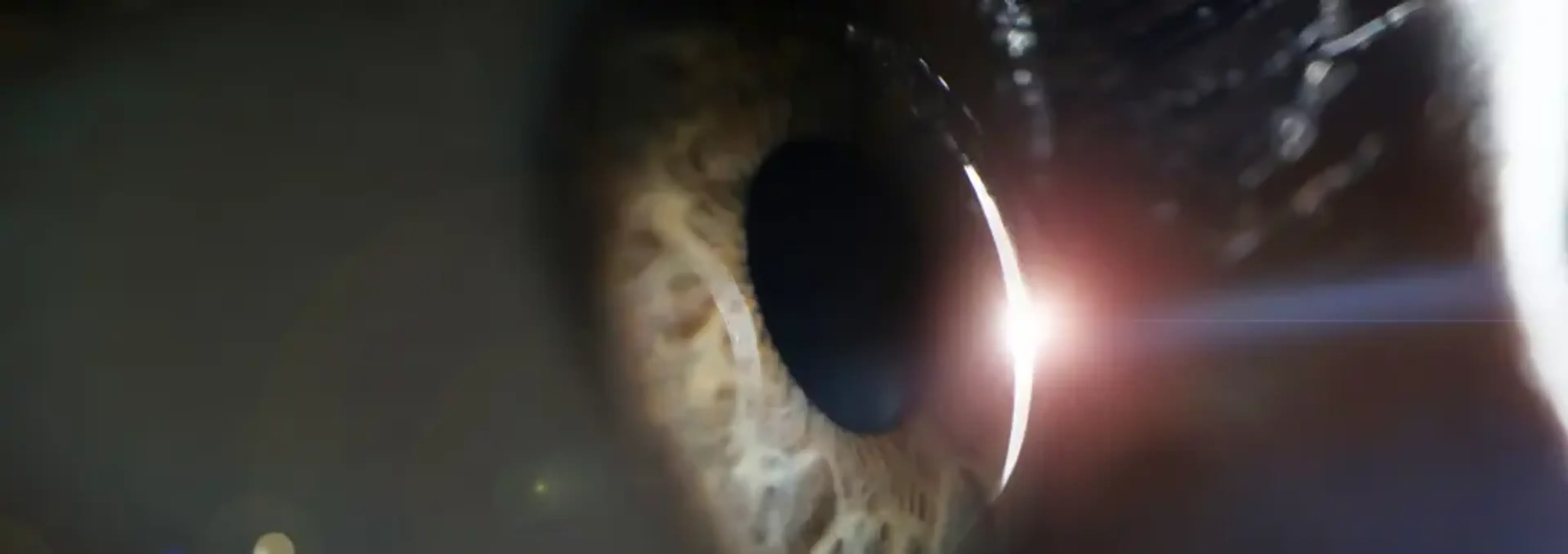 GS Eye Center