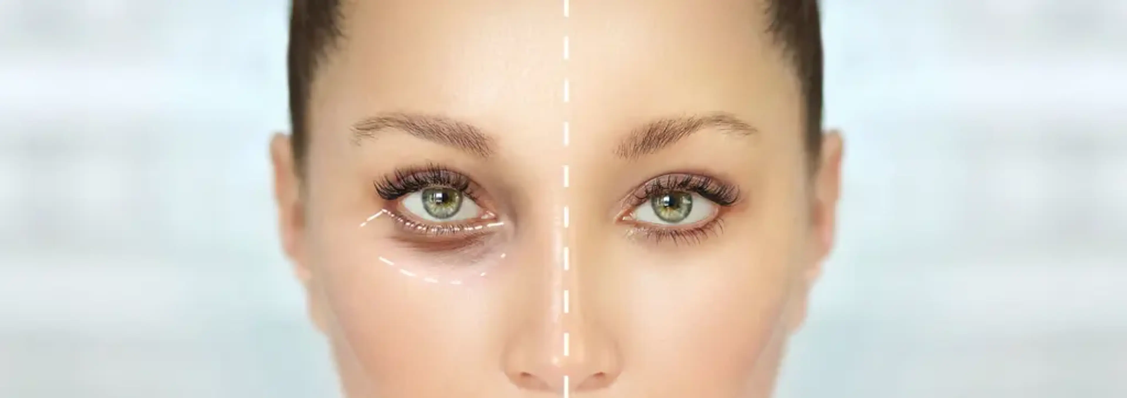 Gangnamseoyon Plastic Surgery