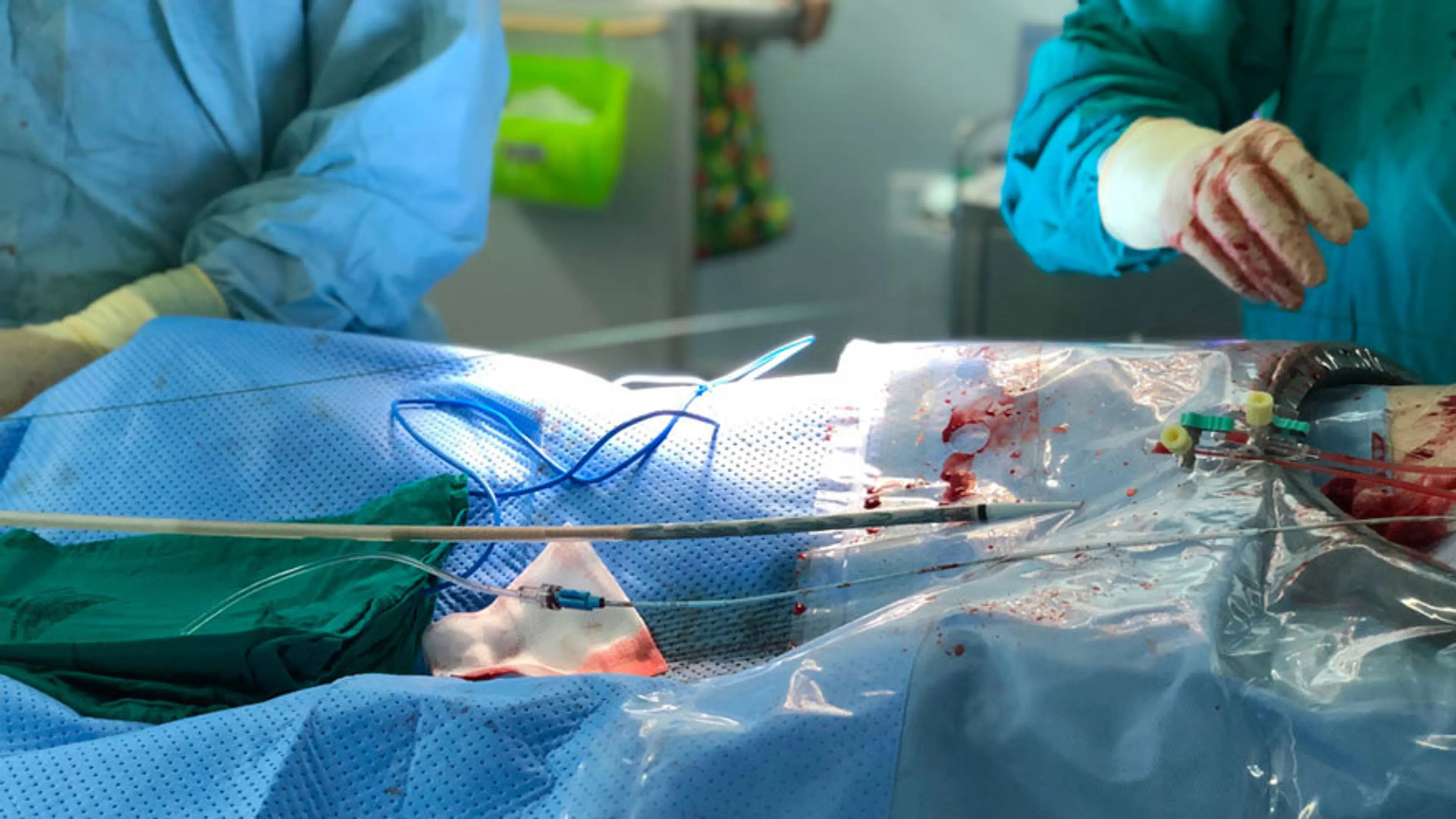Hybrid Surgery