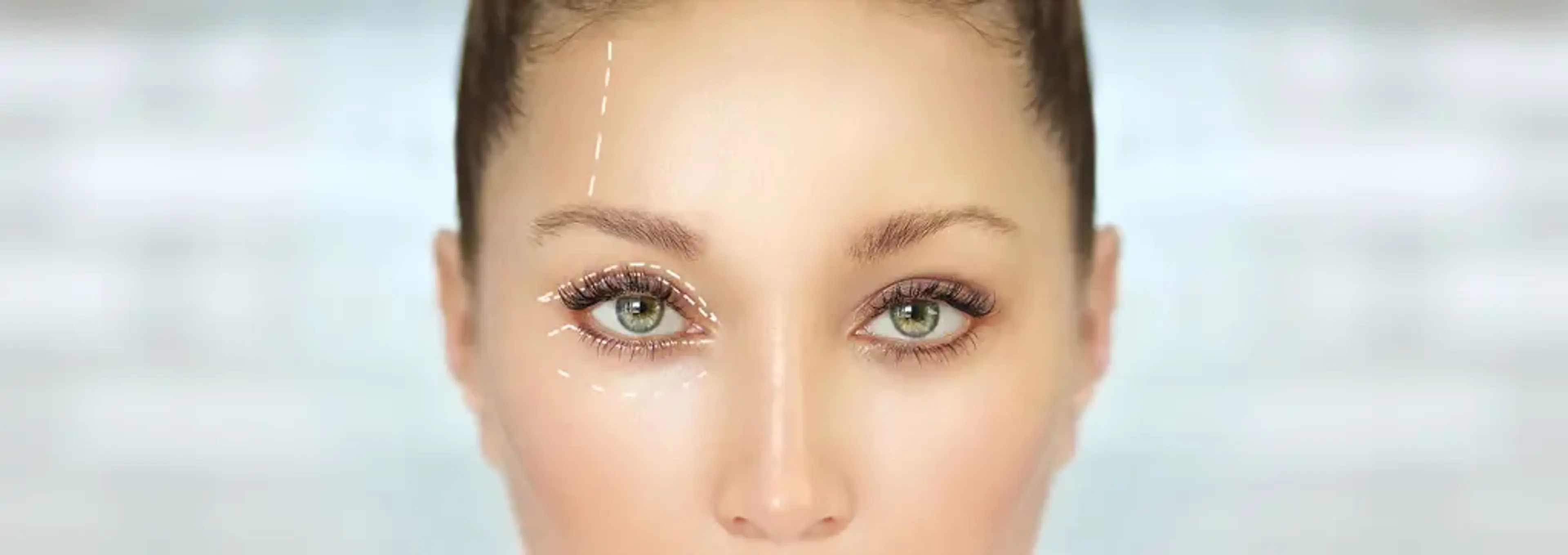 Gangnamseoyon Plastic Surgery