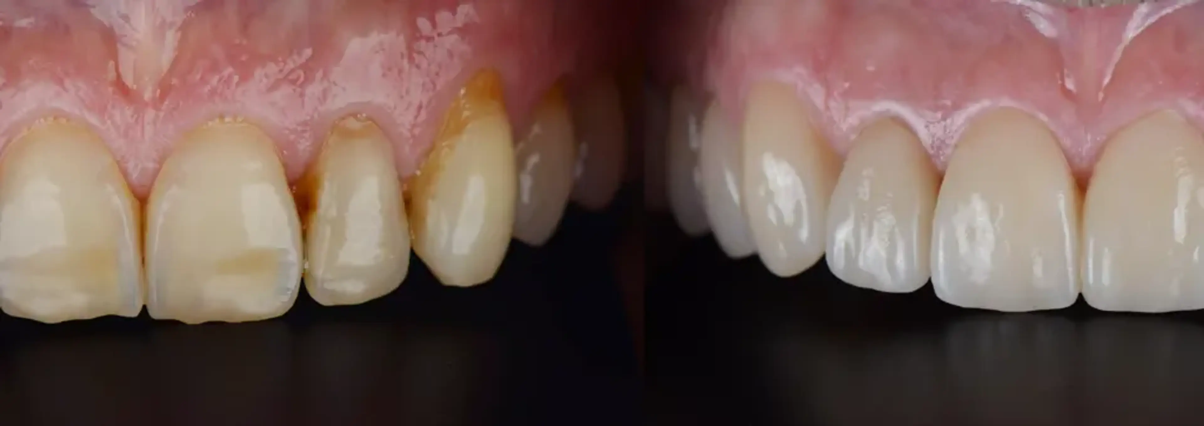 Ye-On Dental Clinic