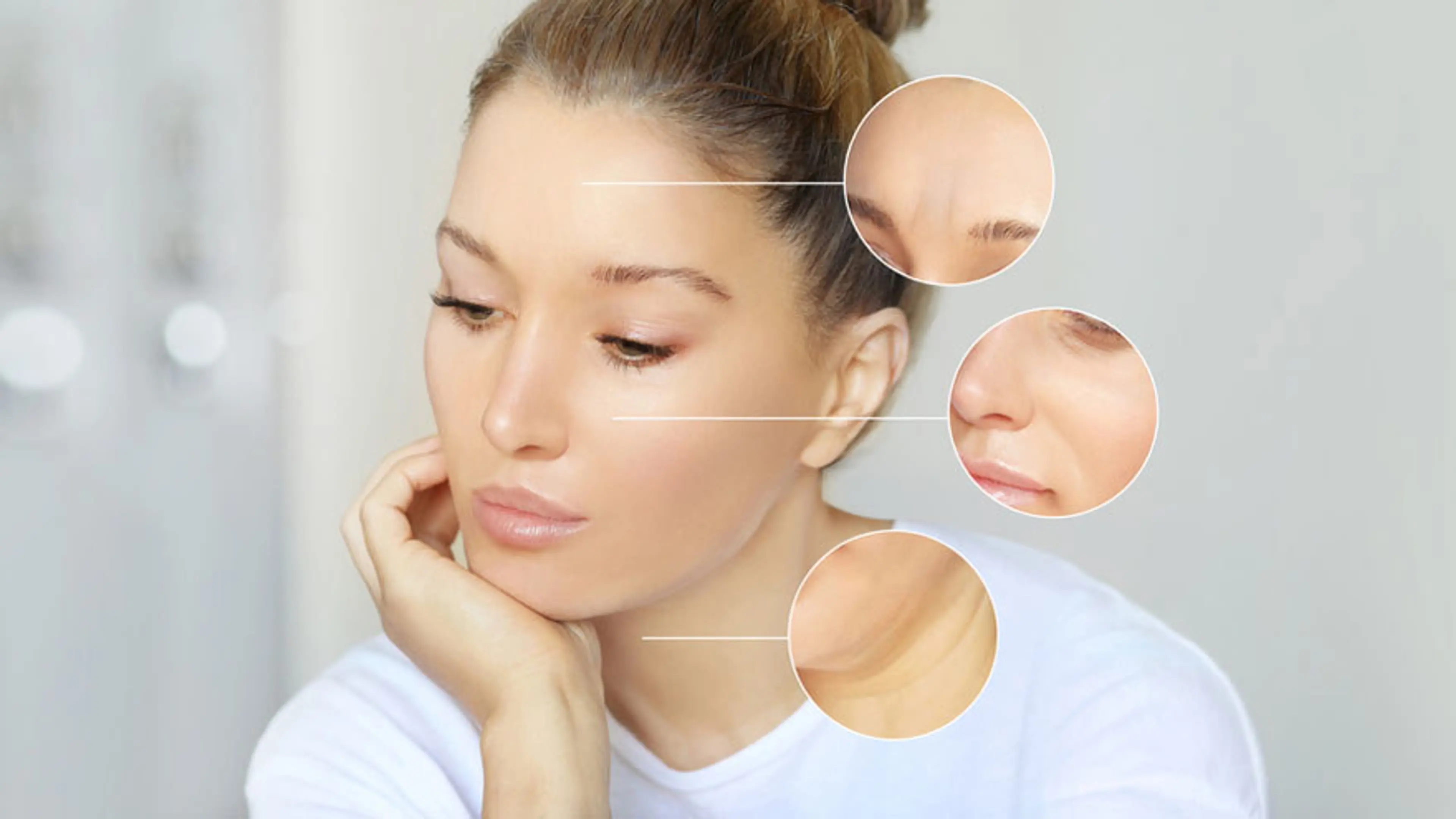 마리오네트 주름