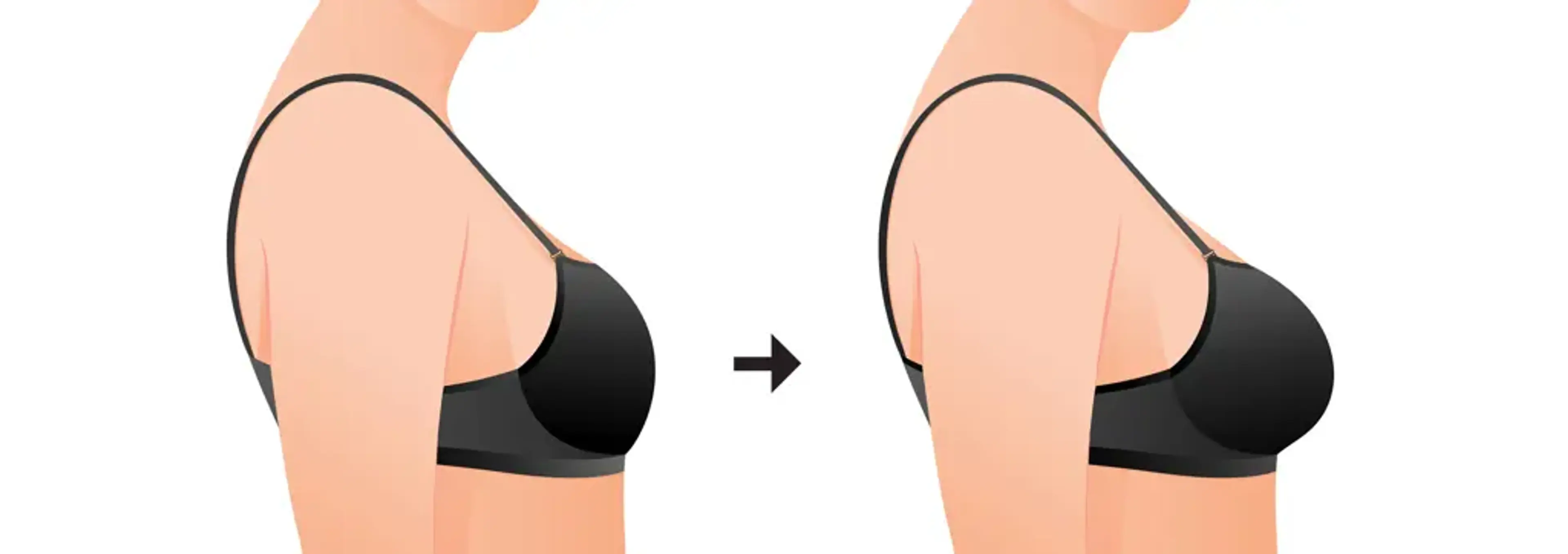 Human Plastic Surgery