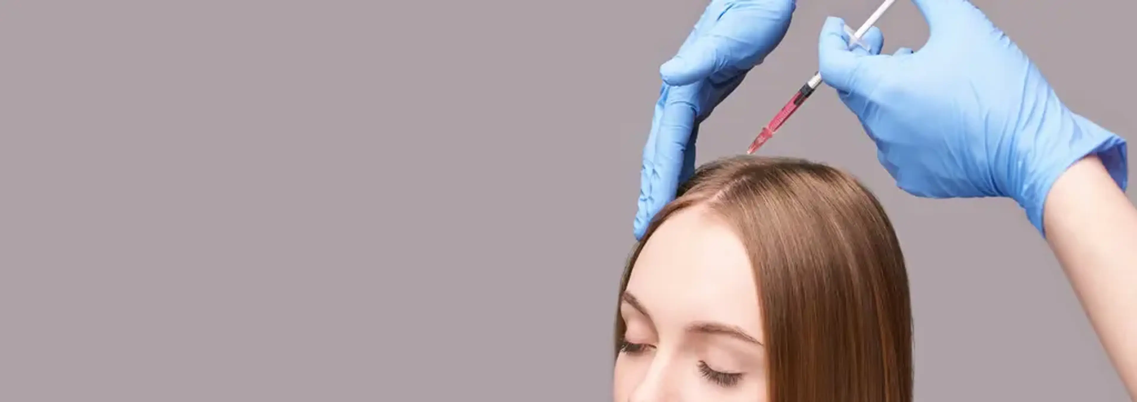 Faktor yang Membuat Terapi Rambut PRP Lebih Efektif dari Waktu ke Waktu