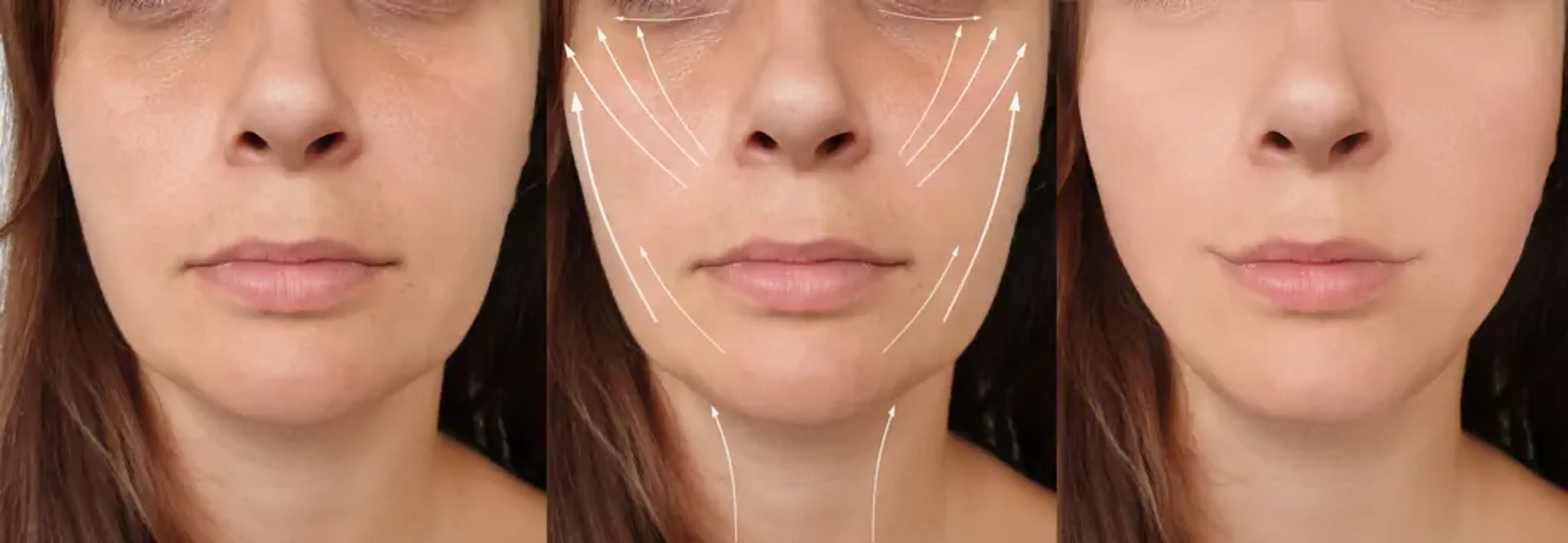 Yujin Plastic Surgery & Dermatology & Stem Cell Research Center