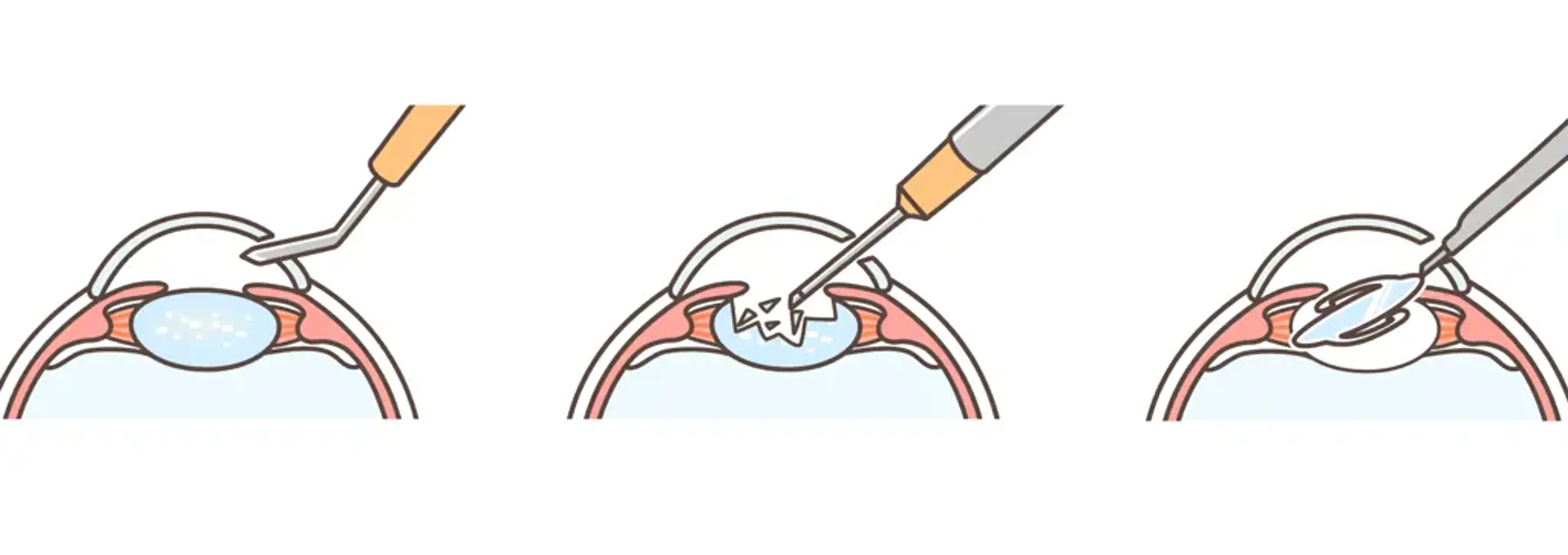 GS Eye Center