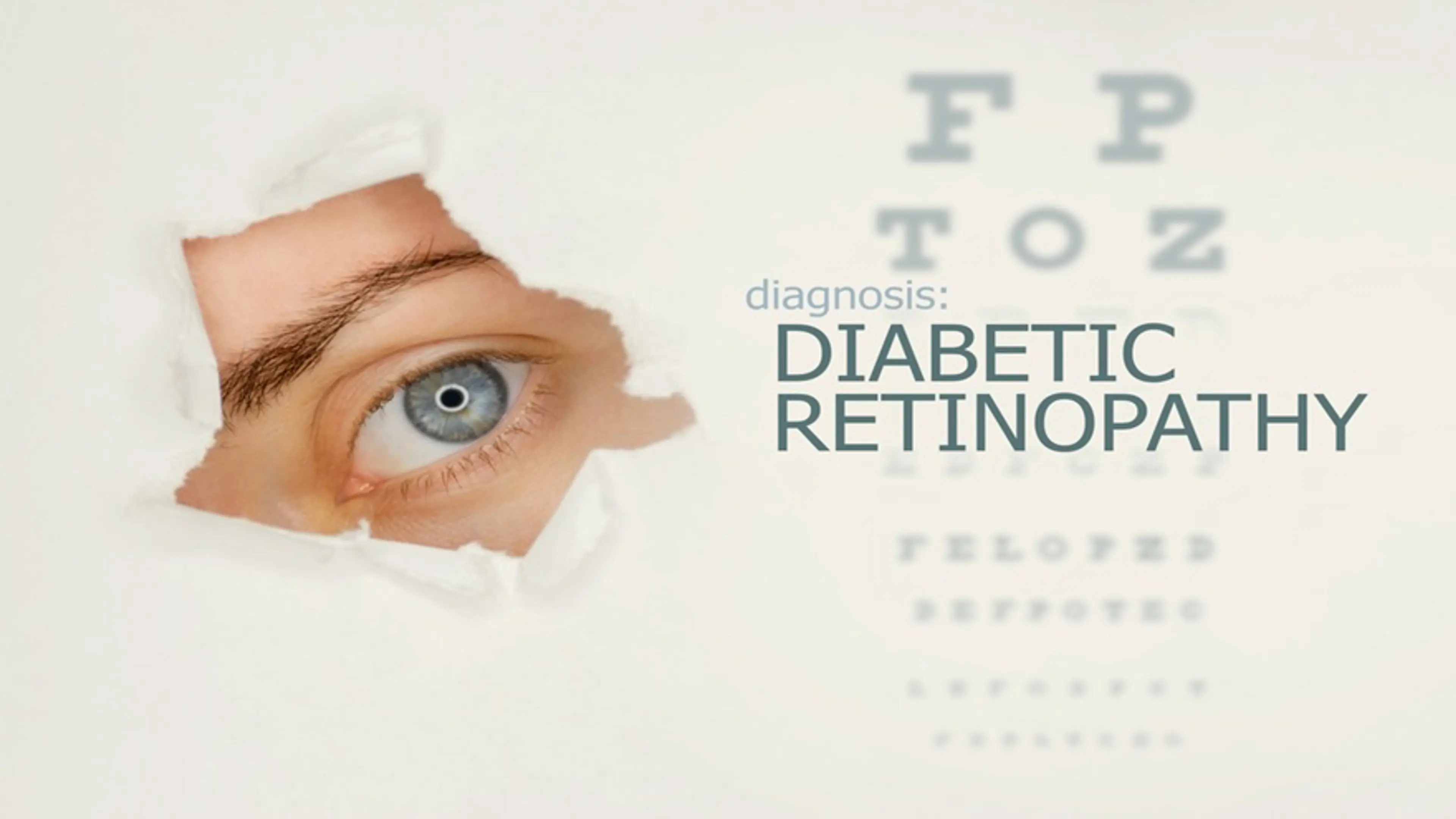 Diabetic Retinopathy