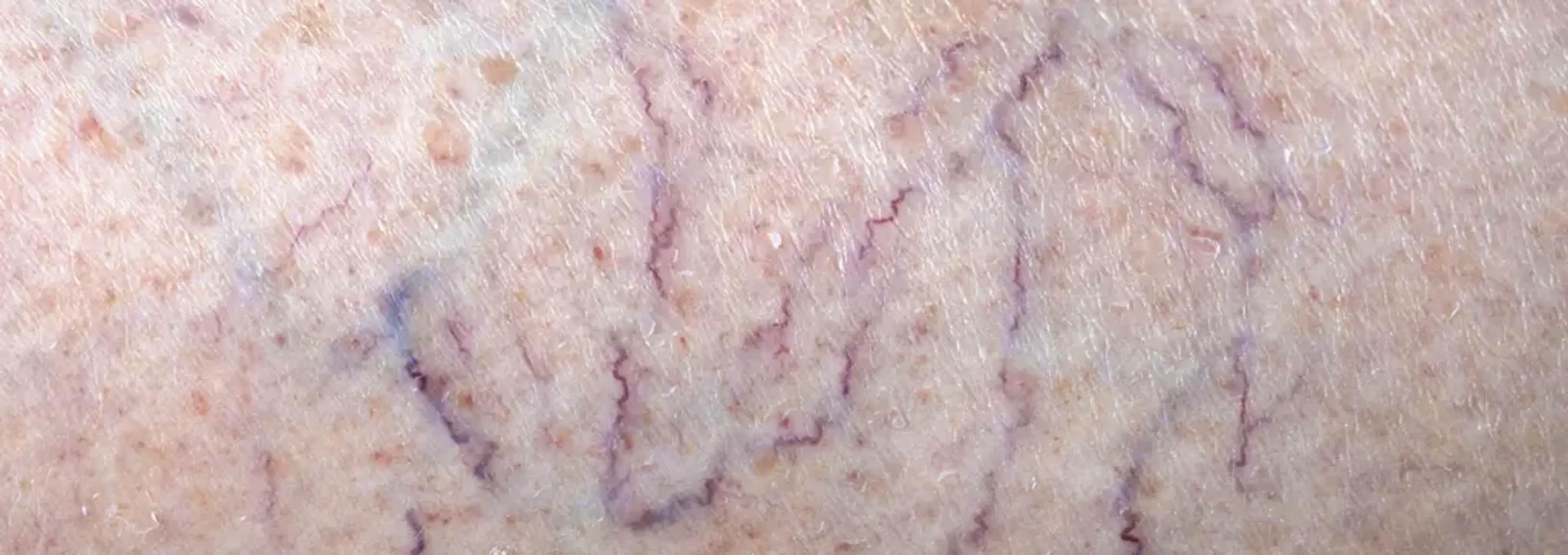 Charm Vascular Clinic