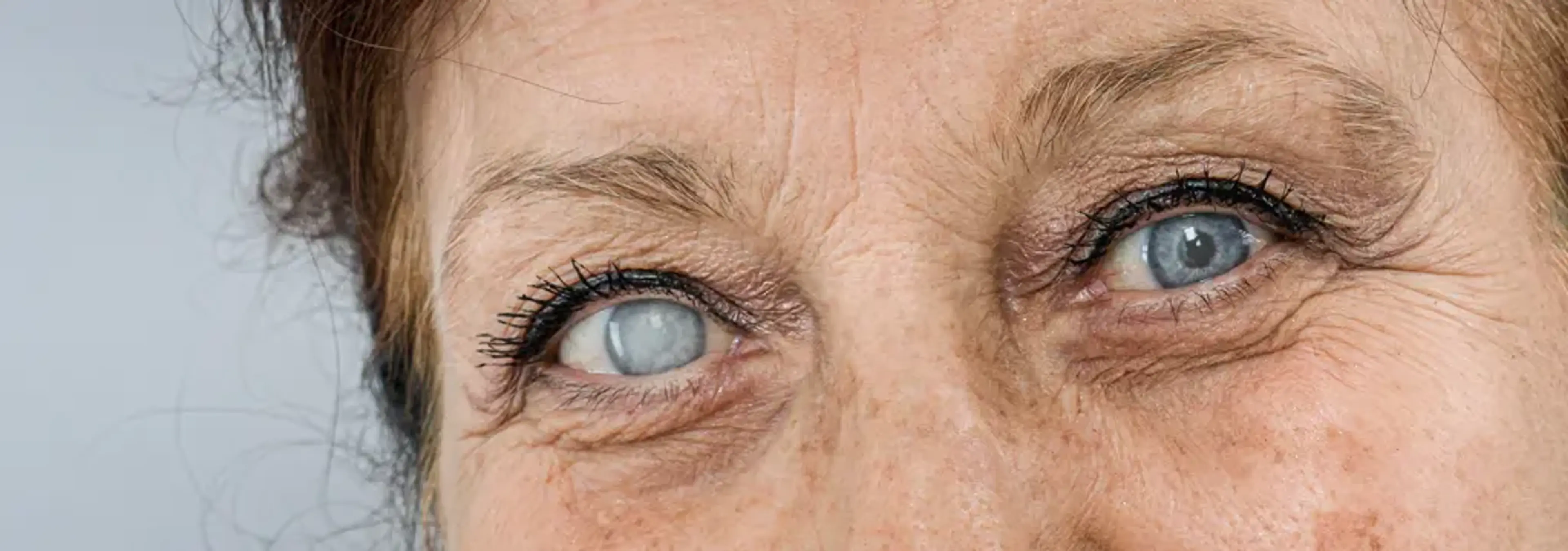 Gangnam Joeunnun Vision Clinic