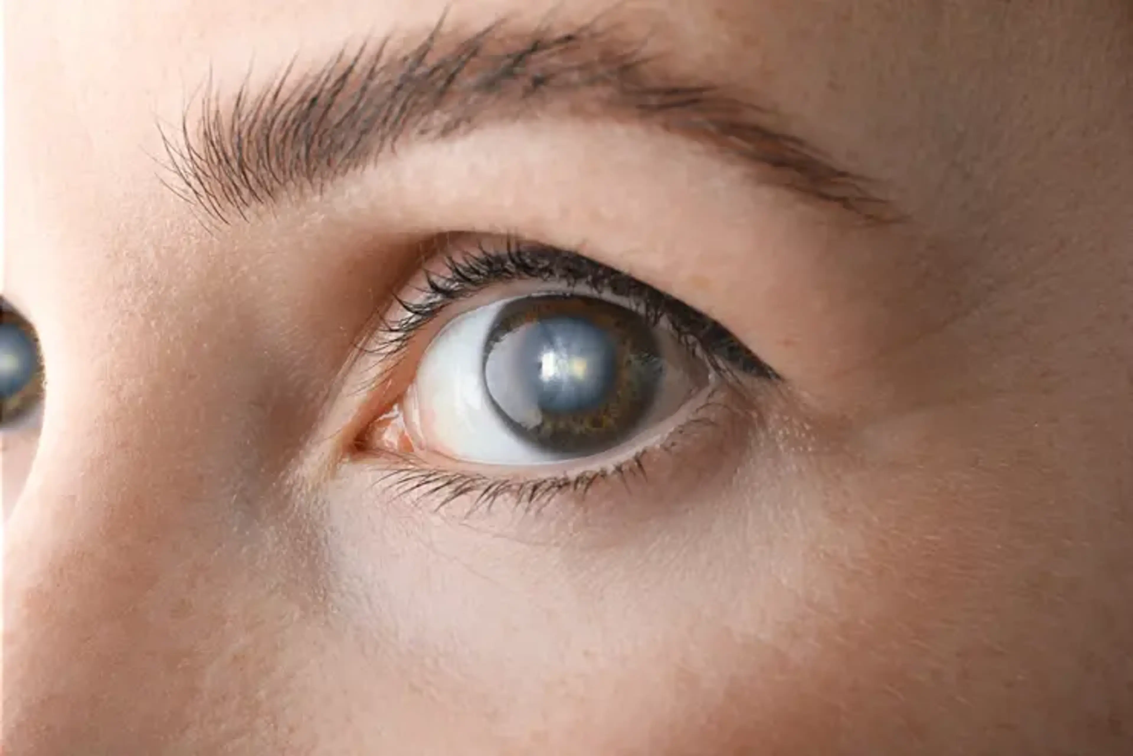 SNU Eye Clinic