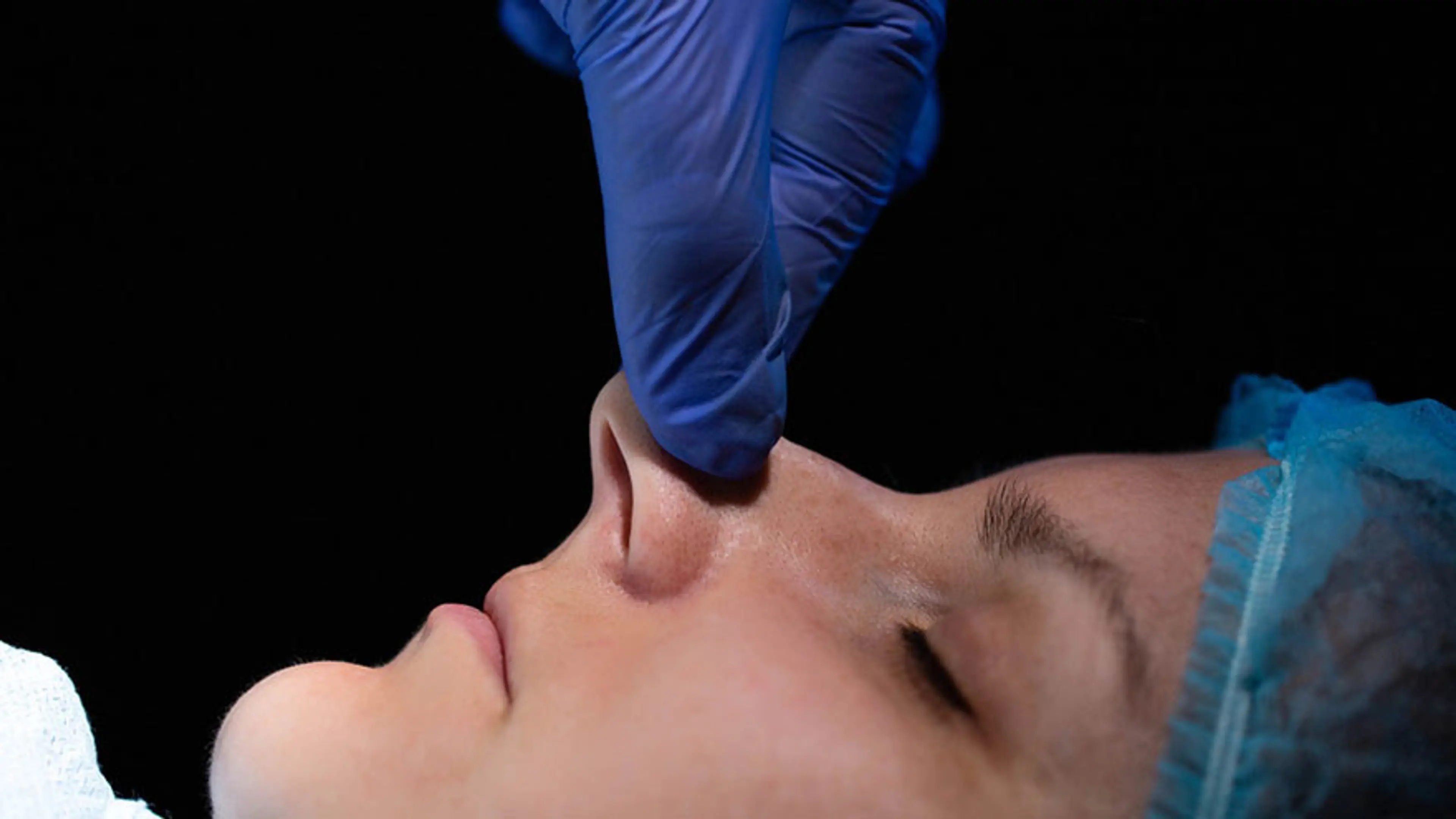 Nostril Reduction