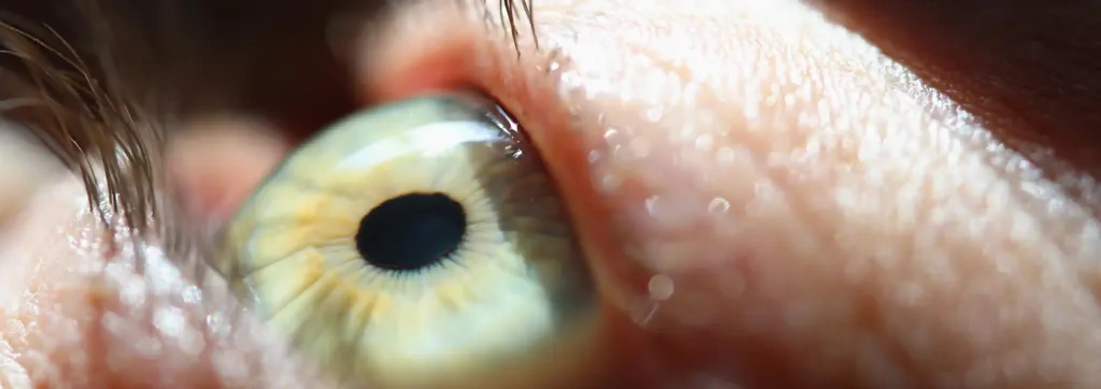 SNU Eye Clinic