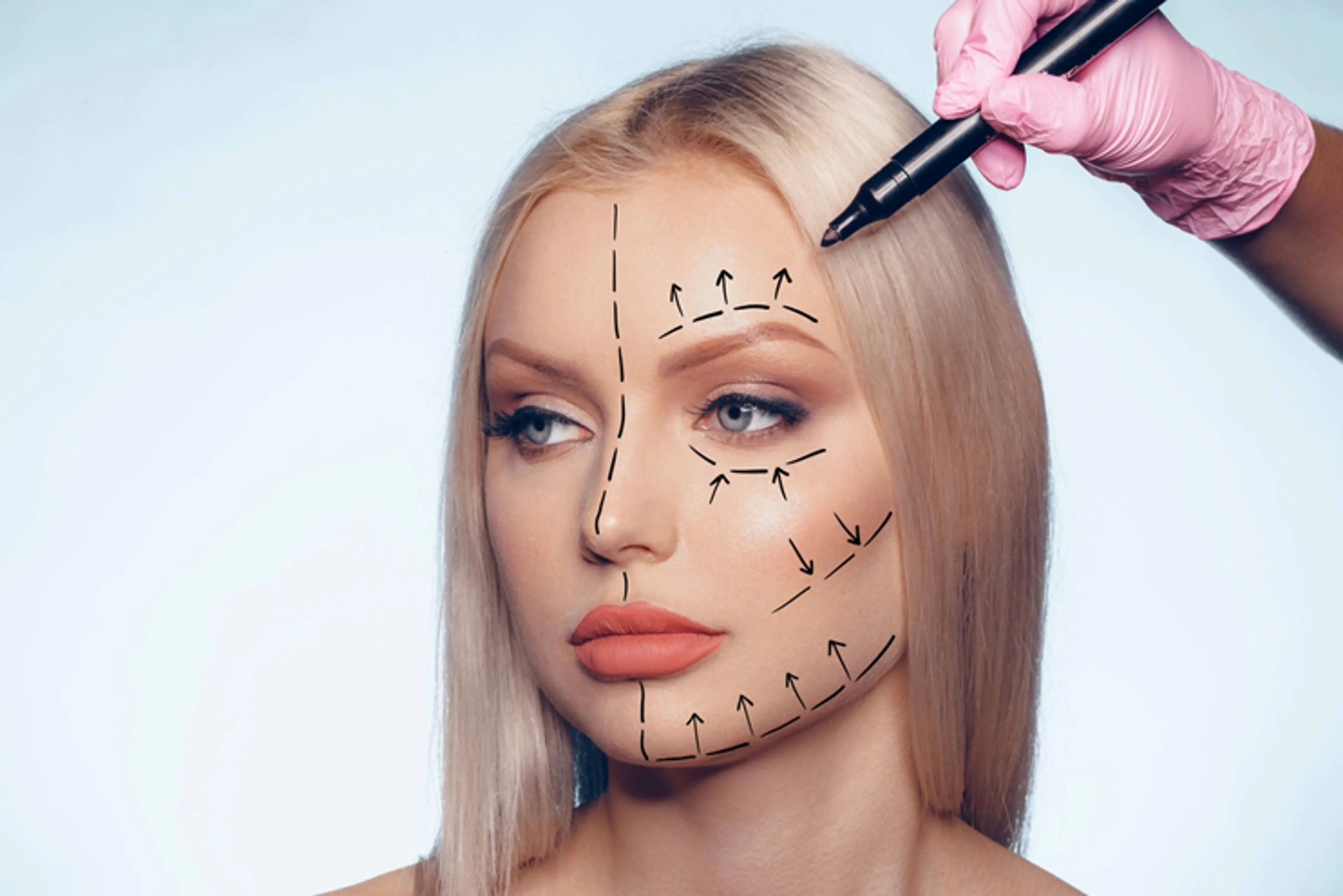 Eyelid Surgery