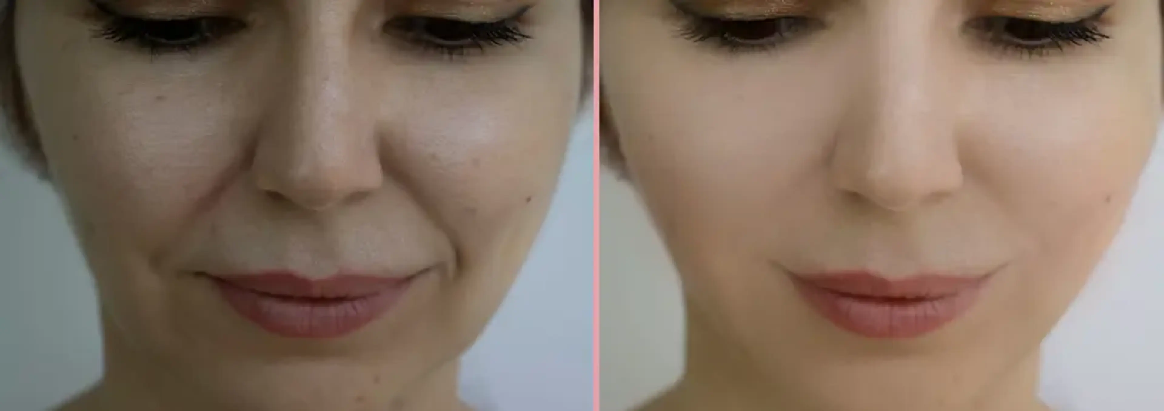 Arke Clinic Plastic Surgery and Aesthetic