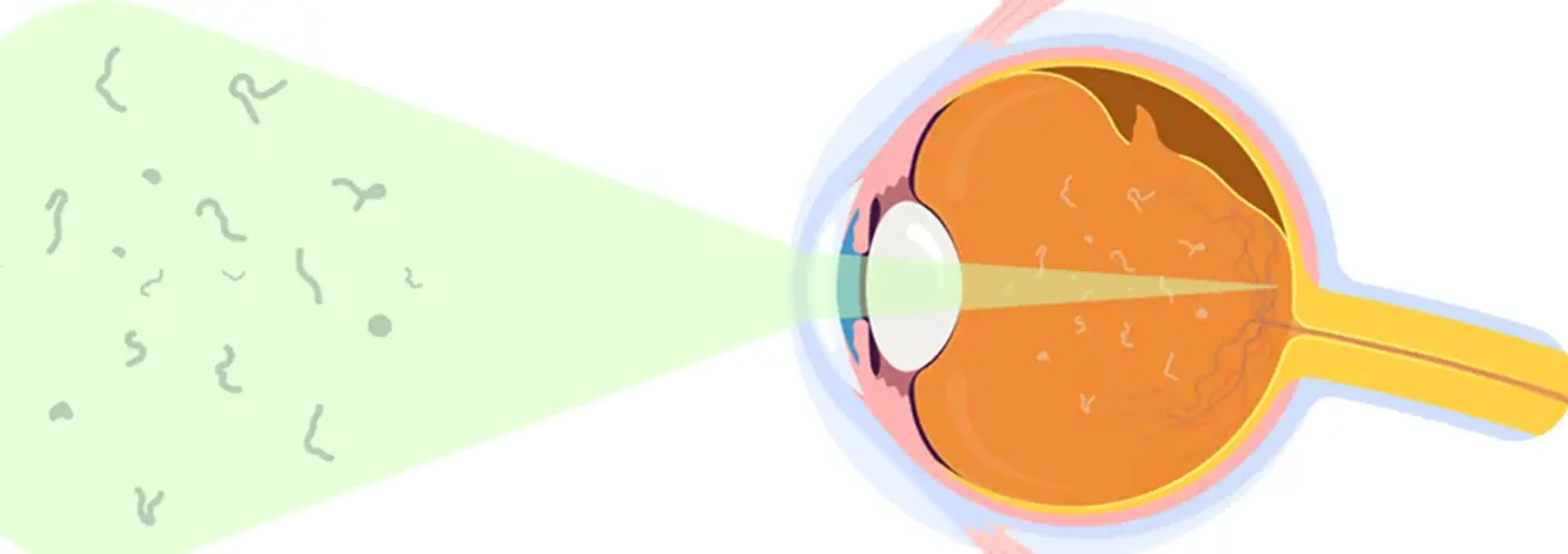 GS Eye Center