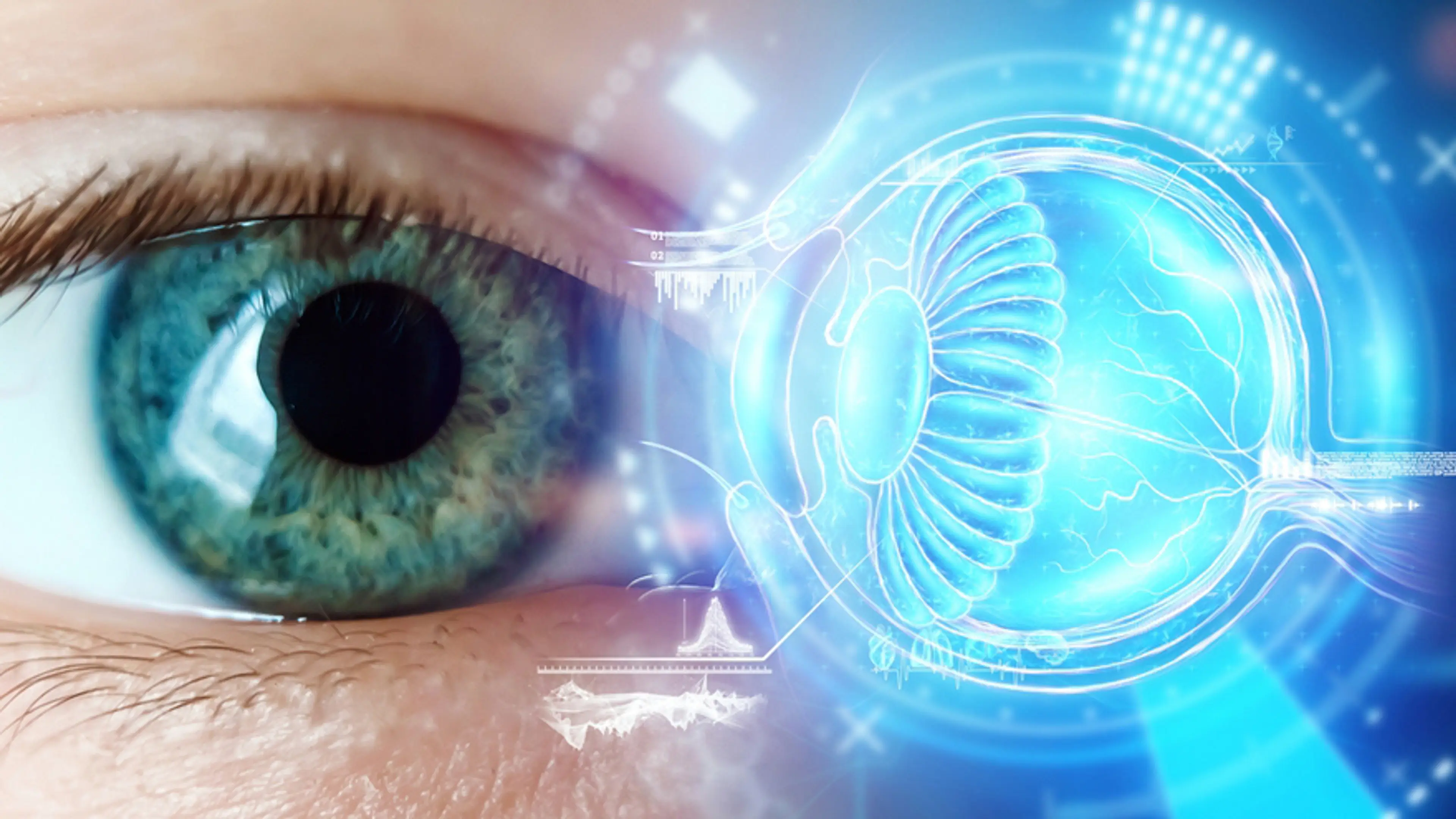 Операция по удалению катаракты