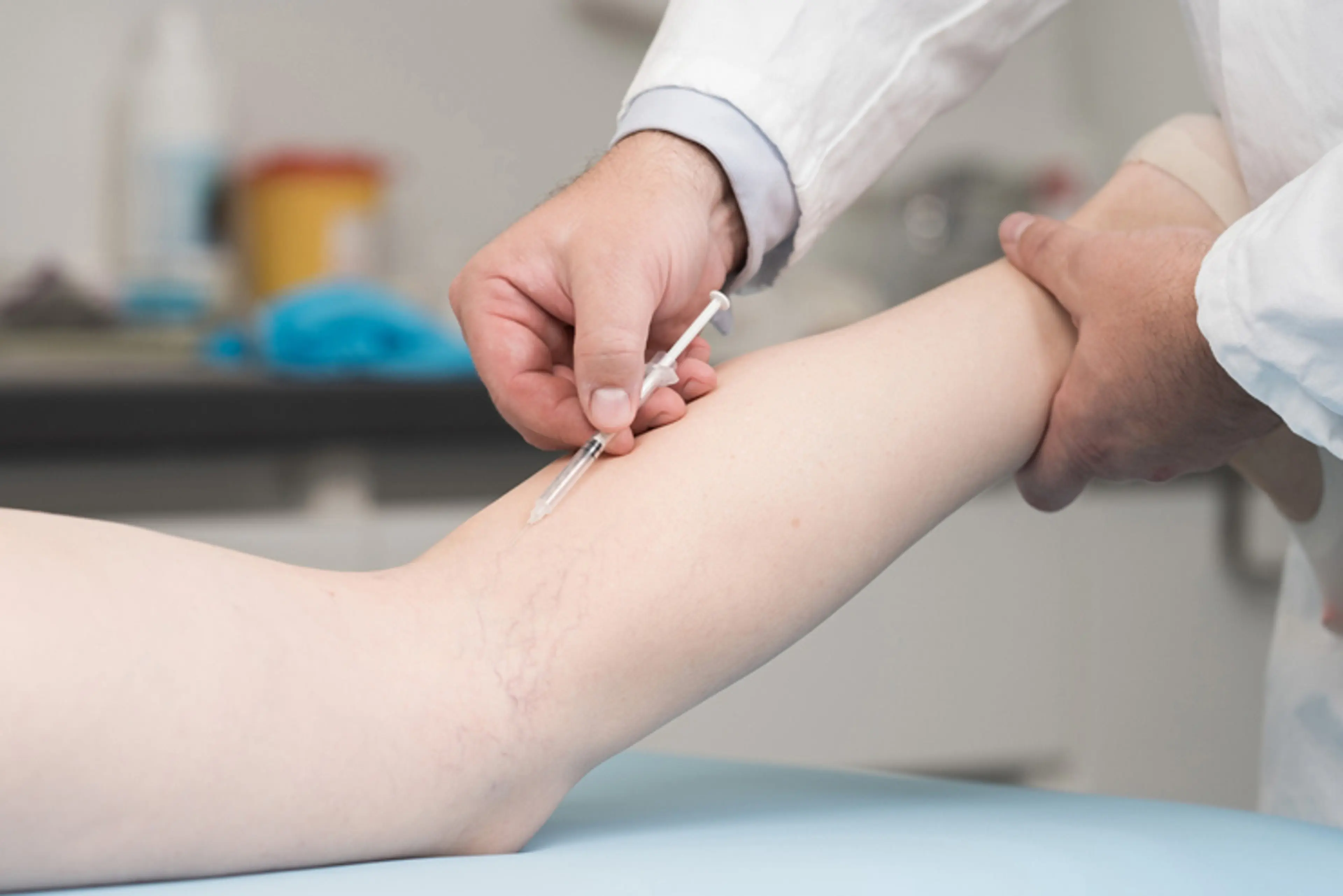 硬化剂注射疗法操作示意图