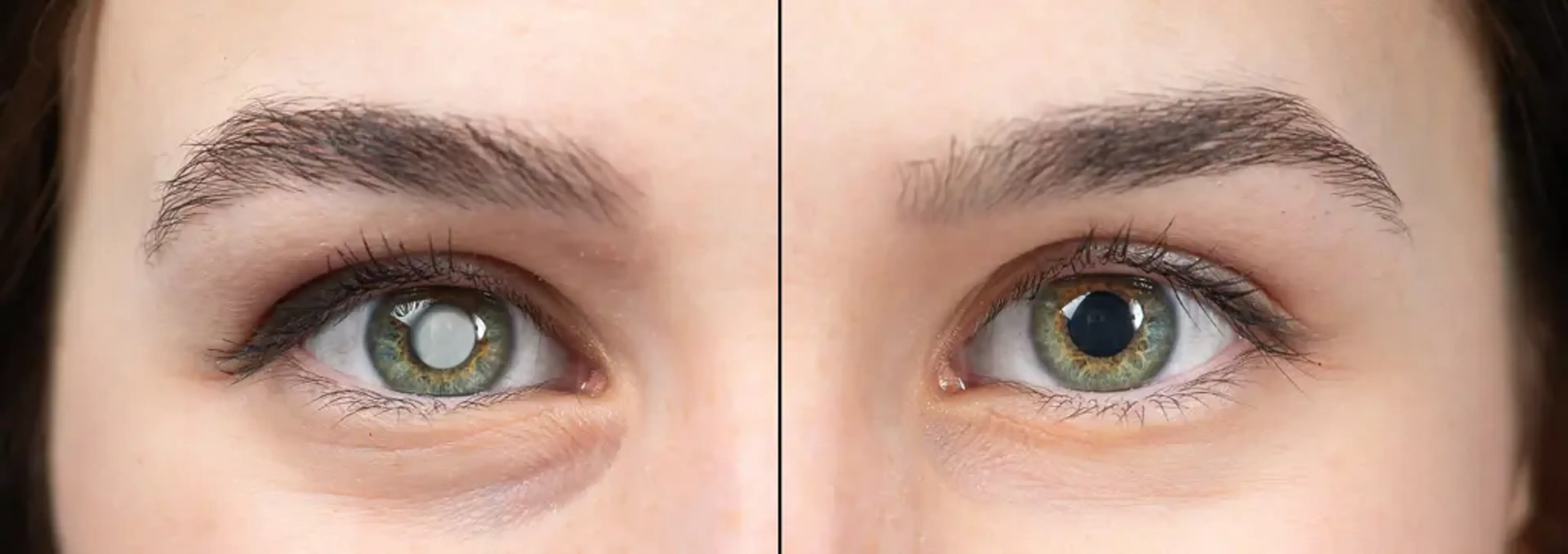 SNU Eye Clinic