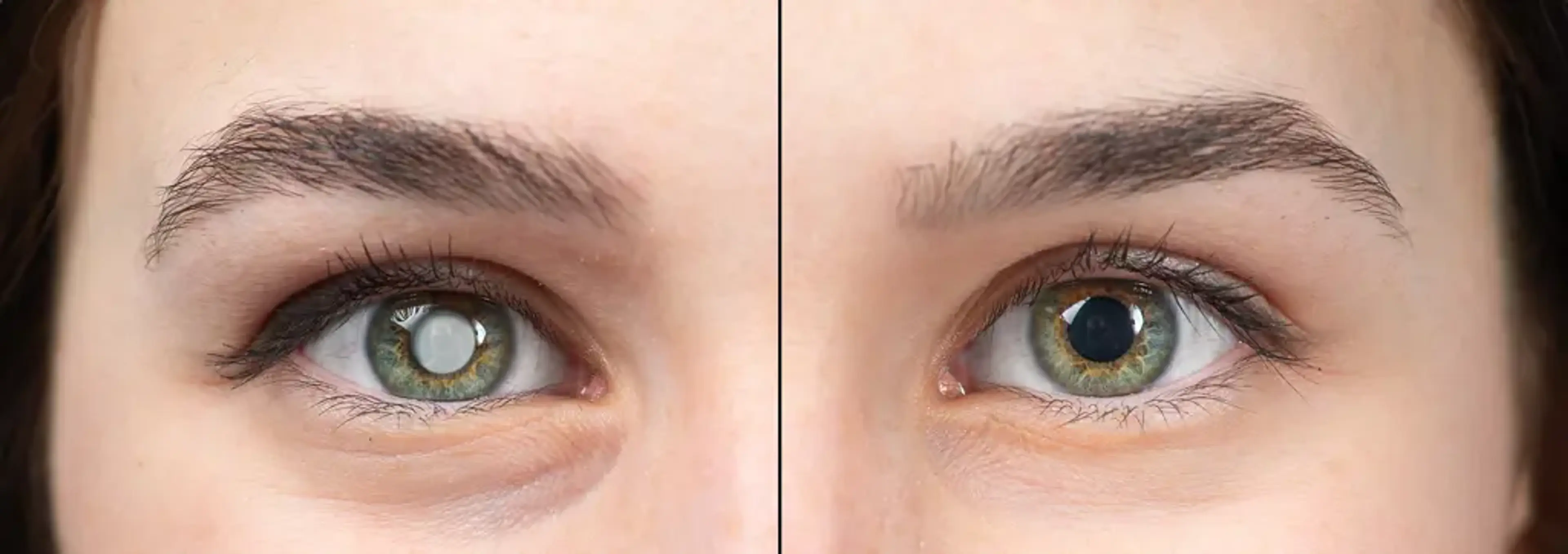 Gangnam Joeunnun Vision Clinic