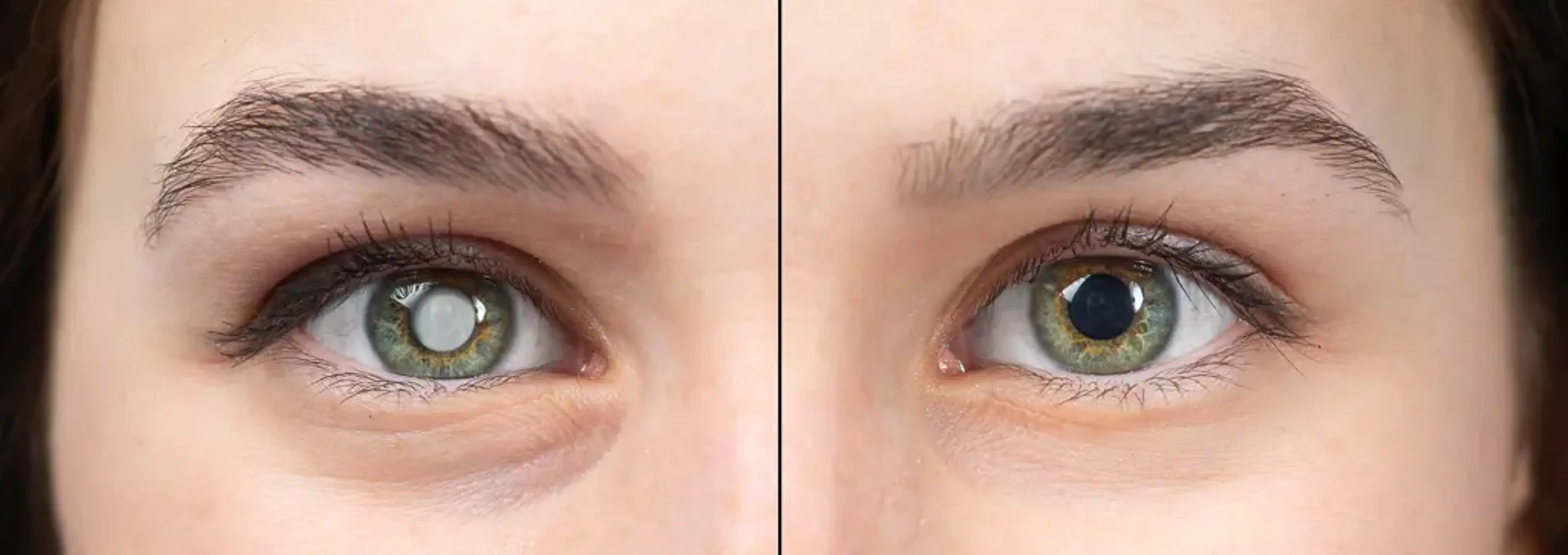 Jryn Eye Clinic