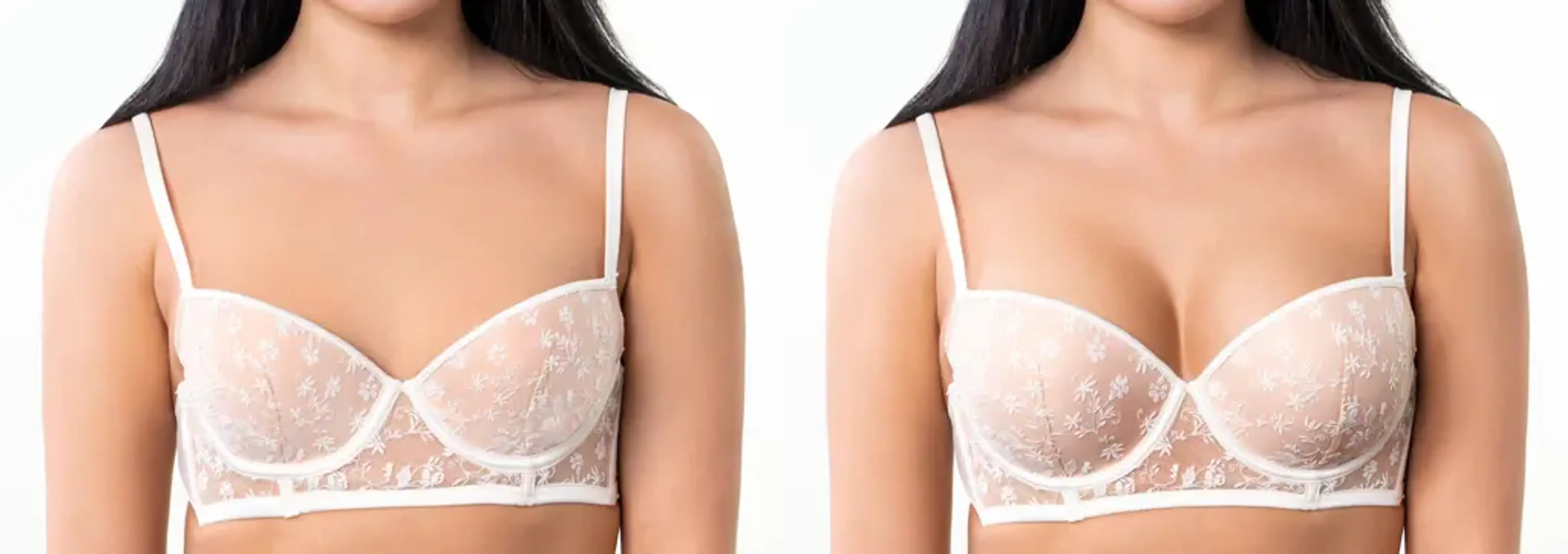 Human Plastic Surgery