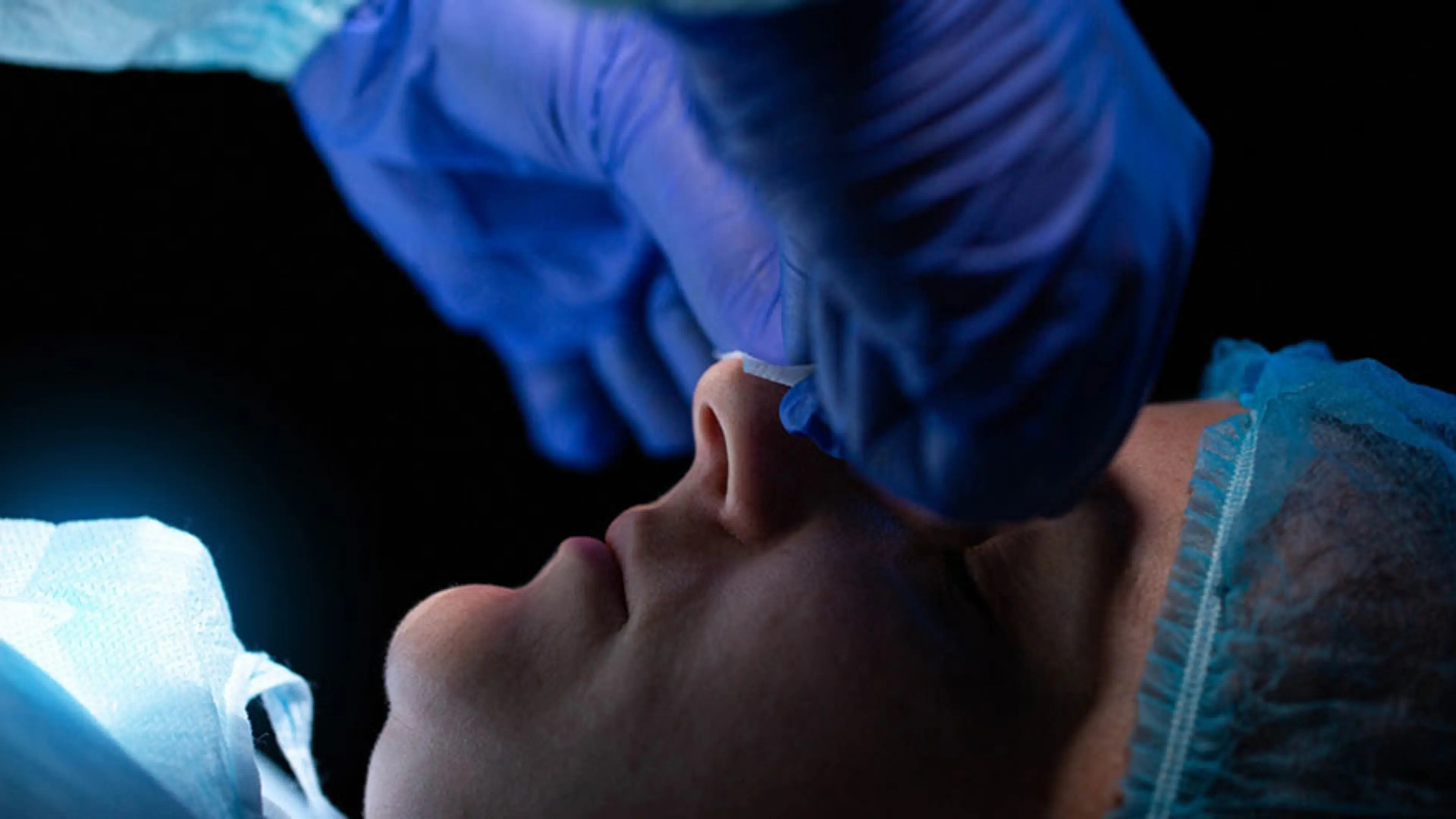 Nostril Reduction Surgery