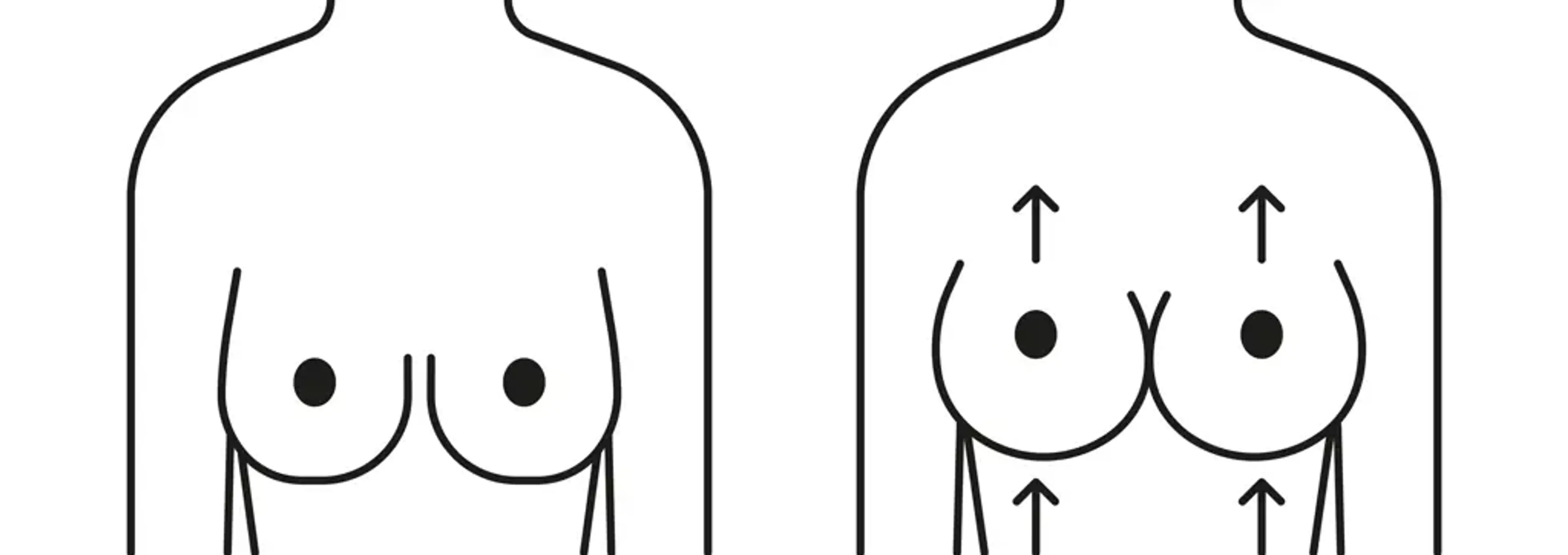 Human Plastic Surgery