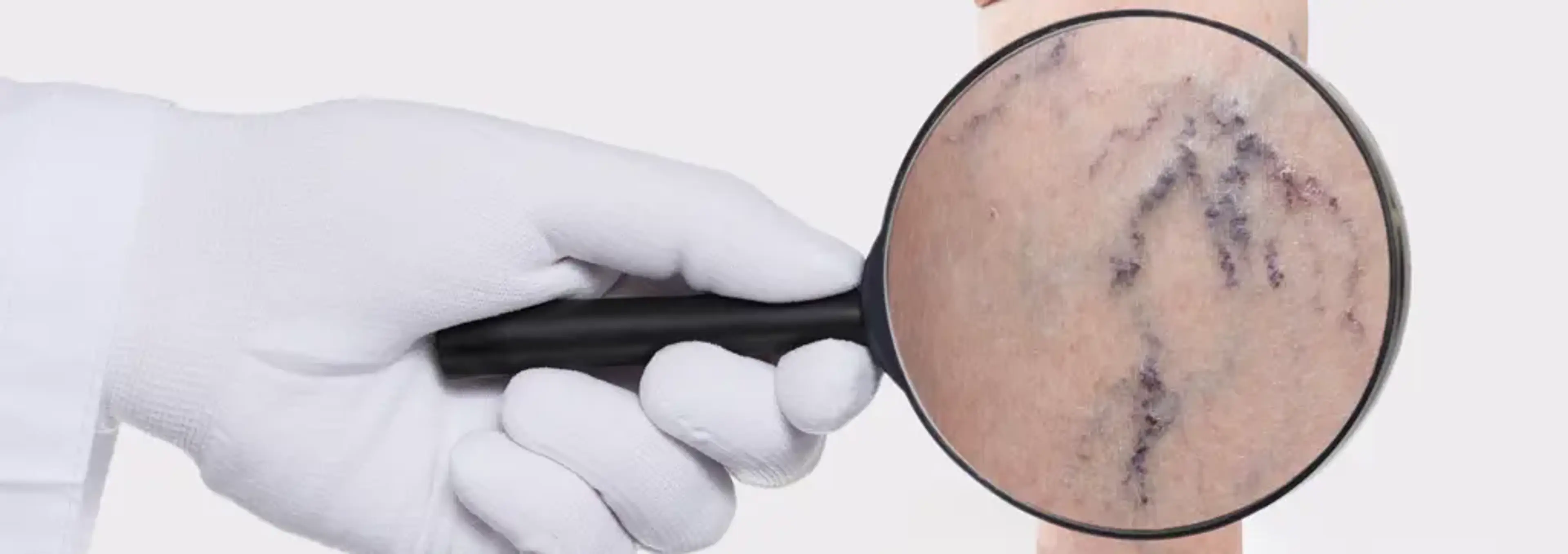 Charm Vascular Clinic